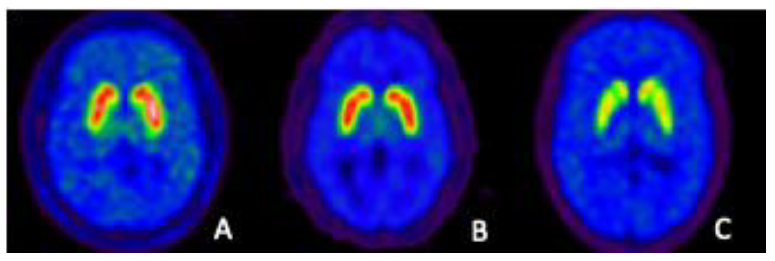 Biomedicines 09 00108 g001