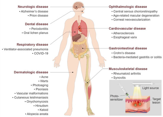 Non-Oncologic Applications of Nanomedicine-Based Phototherapy