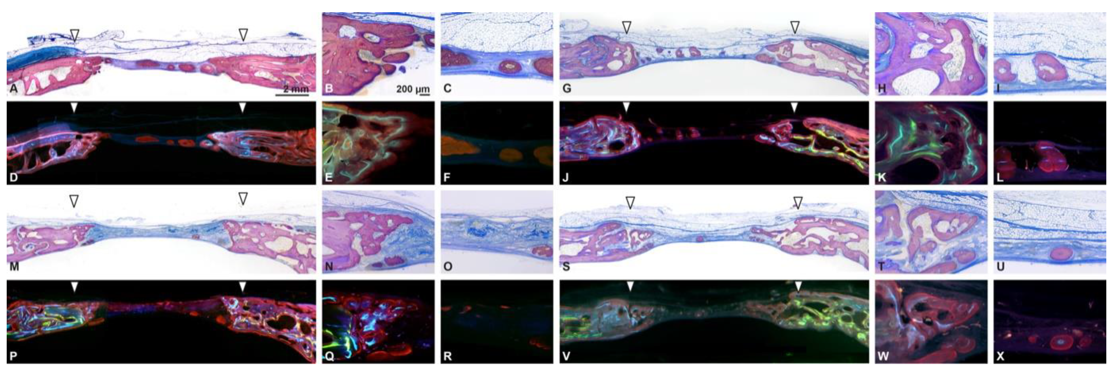 Biomedicines Free Full Text Collagen Based Matrices For Osteoconduction A Preclinical In Vivo Study Html