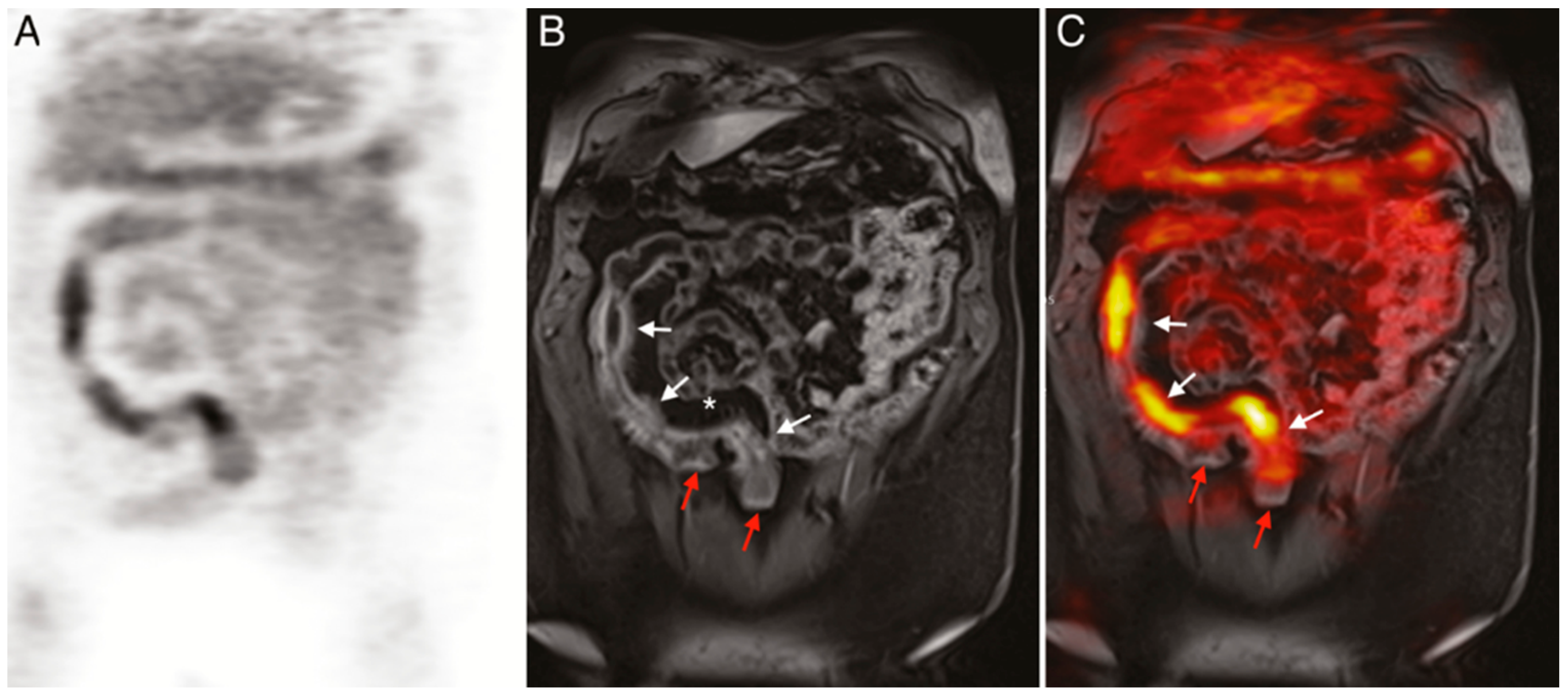 Biomedicines 09 00152 g005 Biomedicines 09 00152 g005