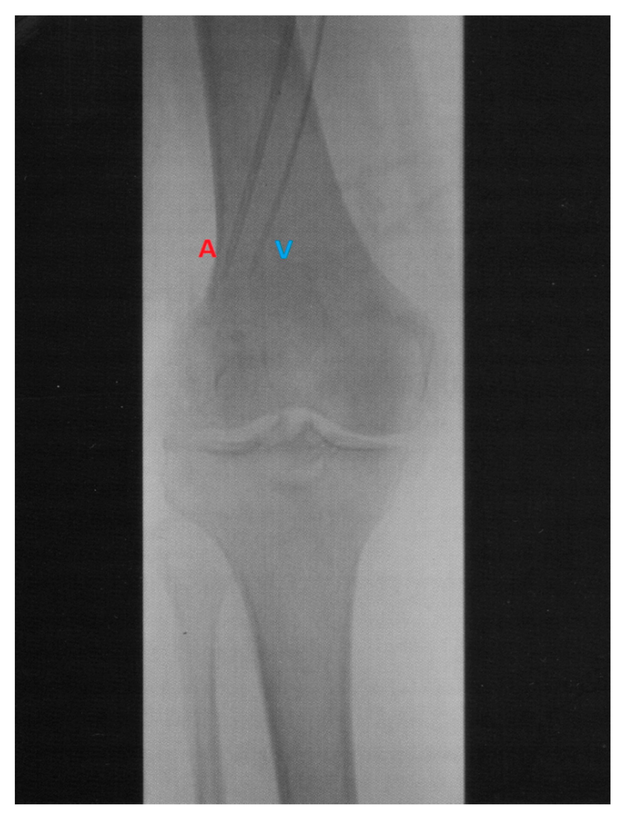 Biomedicines 09 00163 g002 Biomedicines 09 00163 g002