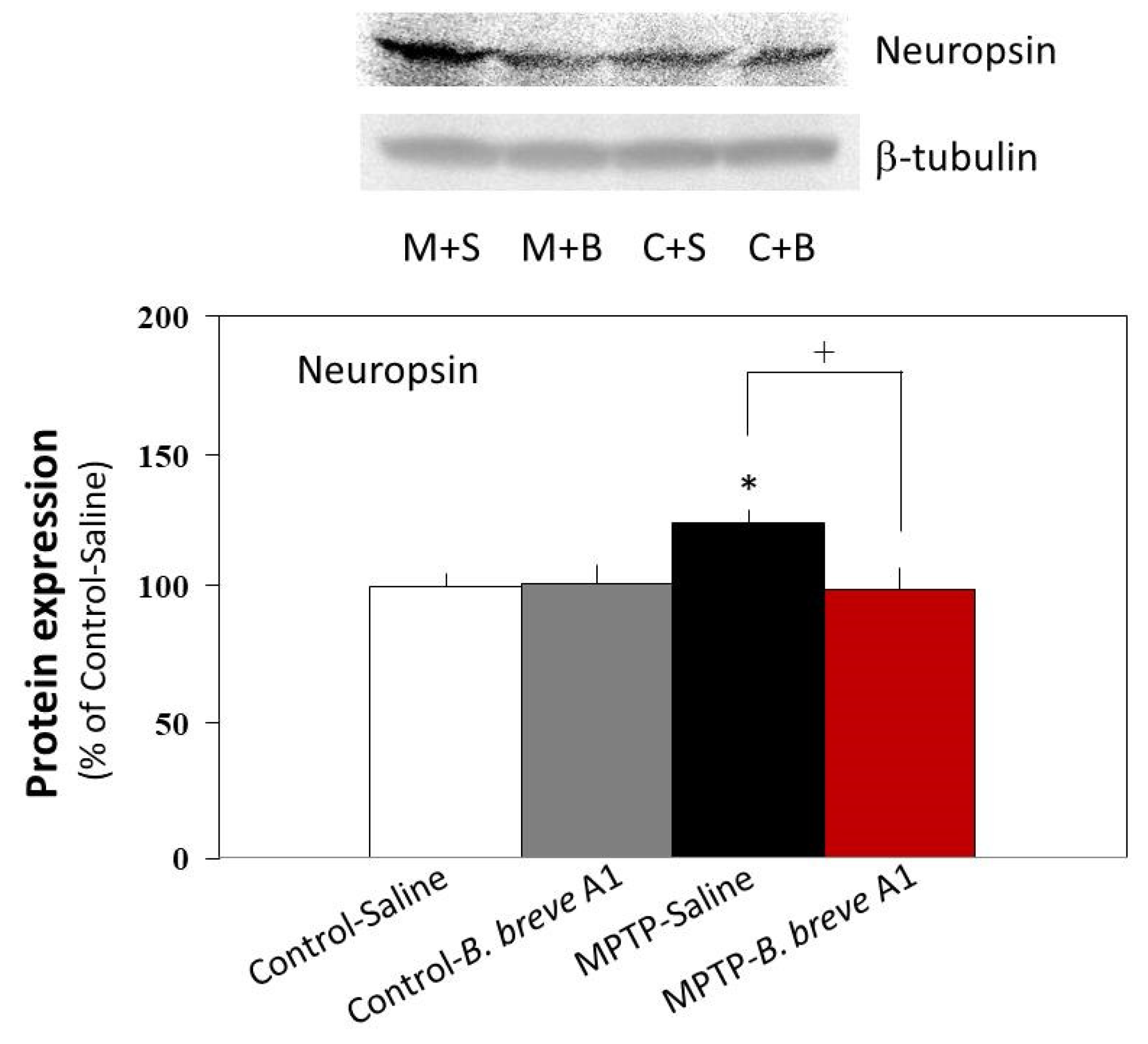 Biomedicines 09 00167 g008 Biomedicines 09 00167 g008