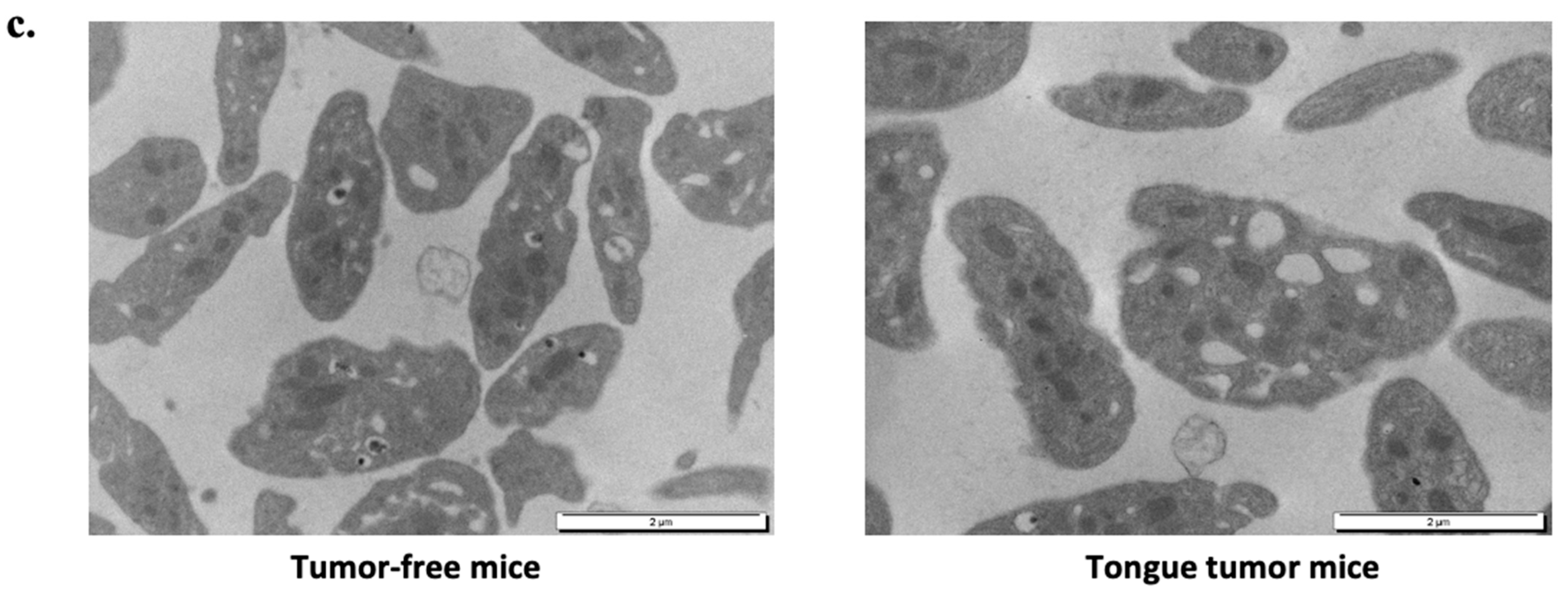 Biomedicines 09 00228 g005b Biomedicines 09 00228 g005b