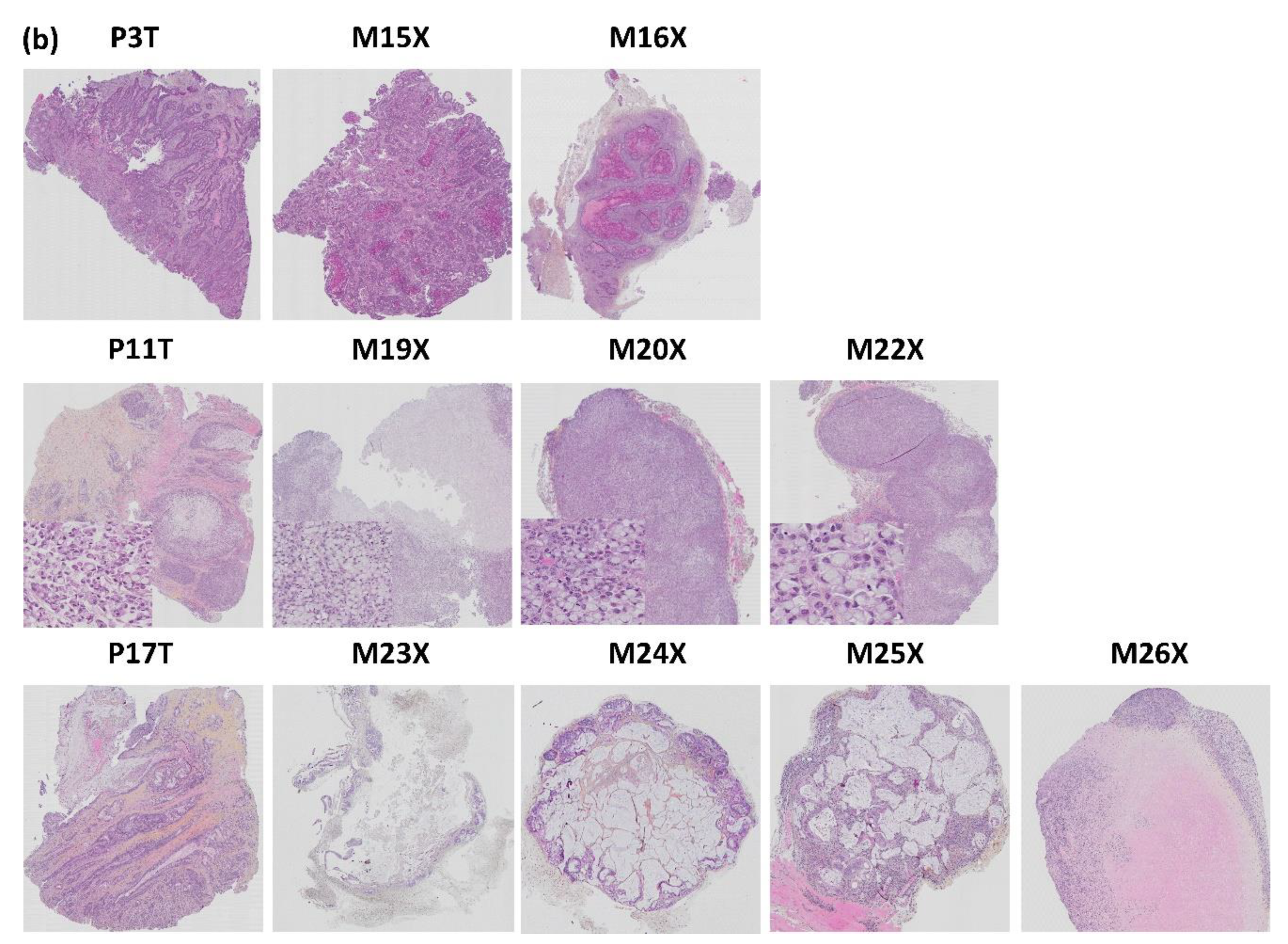 Biomedicines 09 00282 g012b