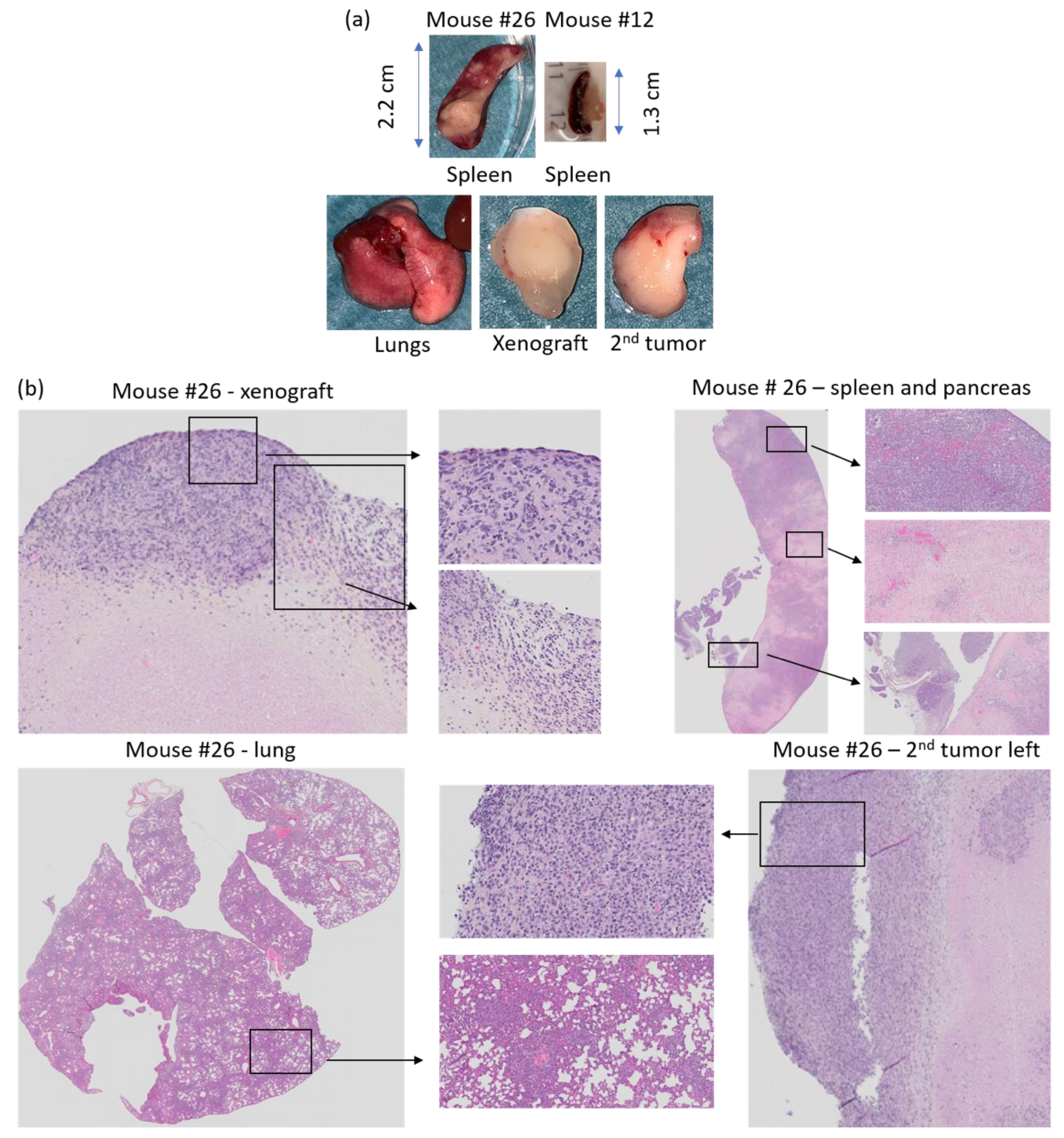 Biomedicines 09 00282 g013