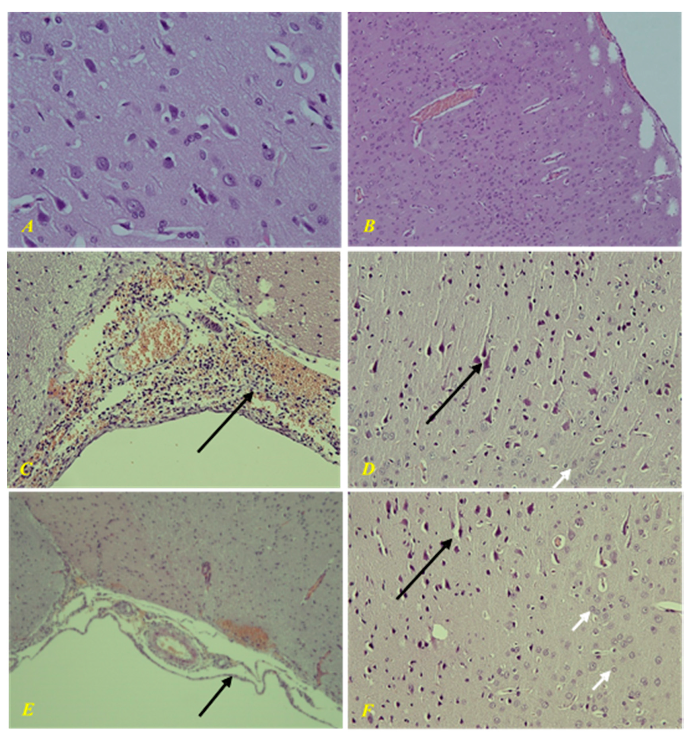 Biomedicines 09 00285 g012