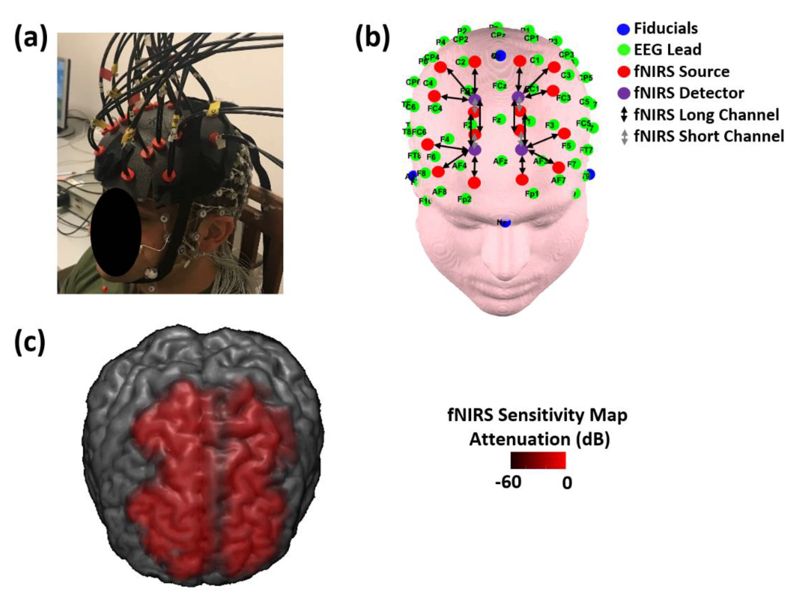 Biomedicines | Free Full-Text | Evidence of Neurovascular Un-Coupling in  Mild Alzheimer's Disease through Multimodal EEG-fNIRS and Multivariate  Analysis of Resting-State Data | HTML