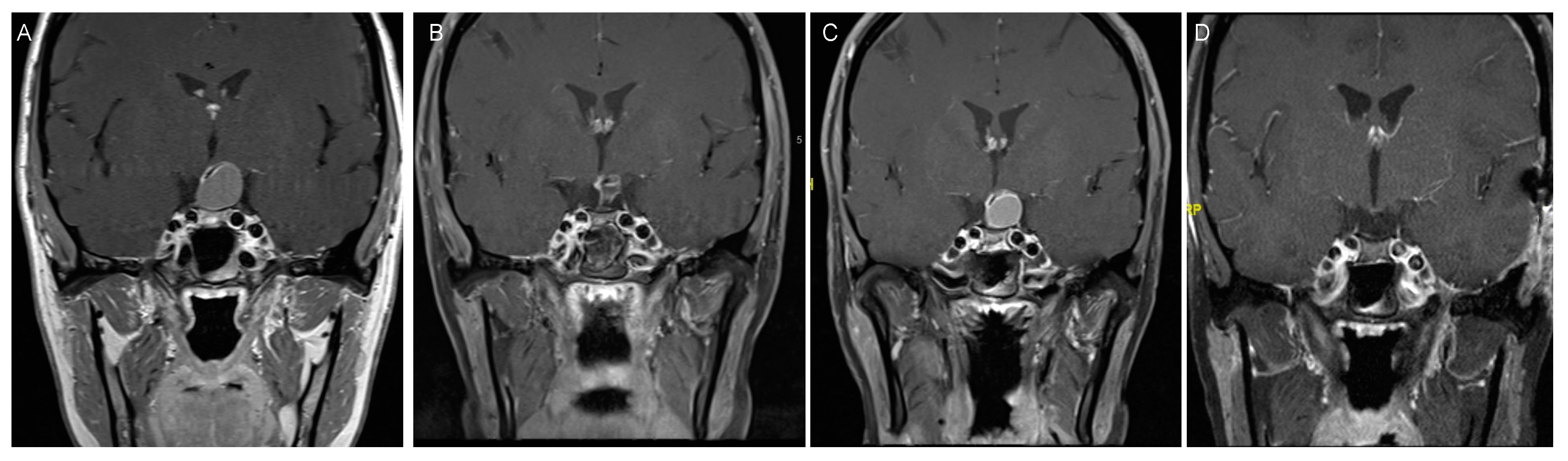Biomedicines 09 00356 g003
