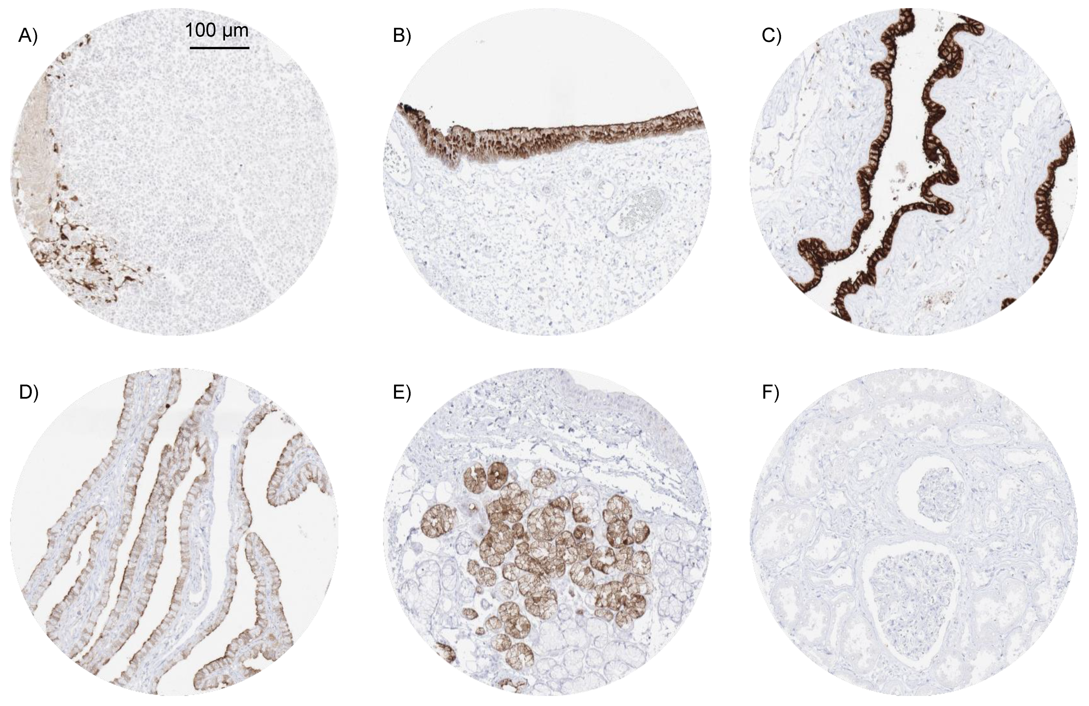 can colon cancer metastasis to the liver