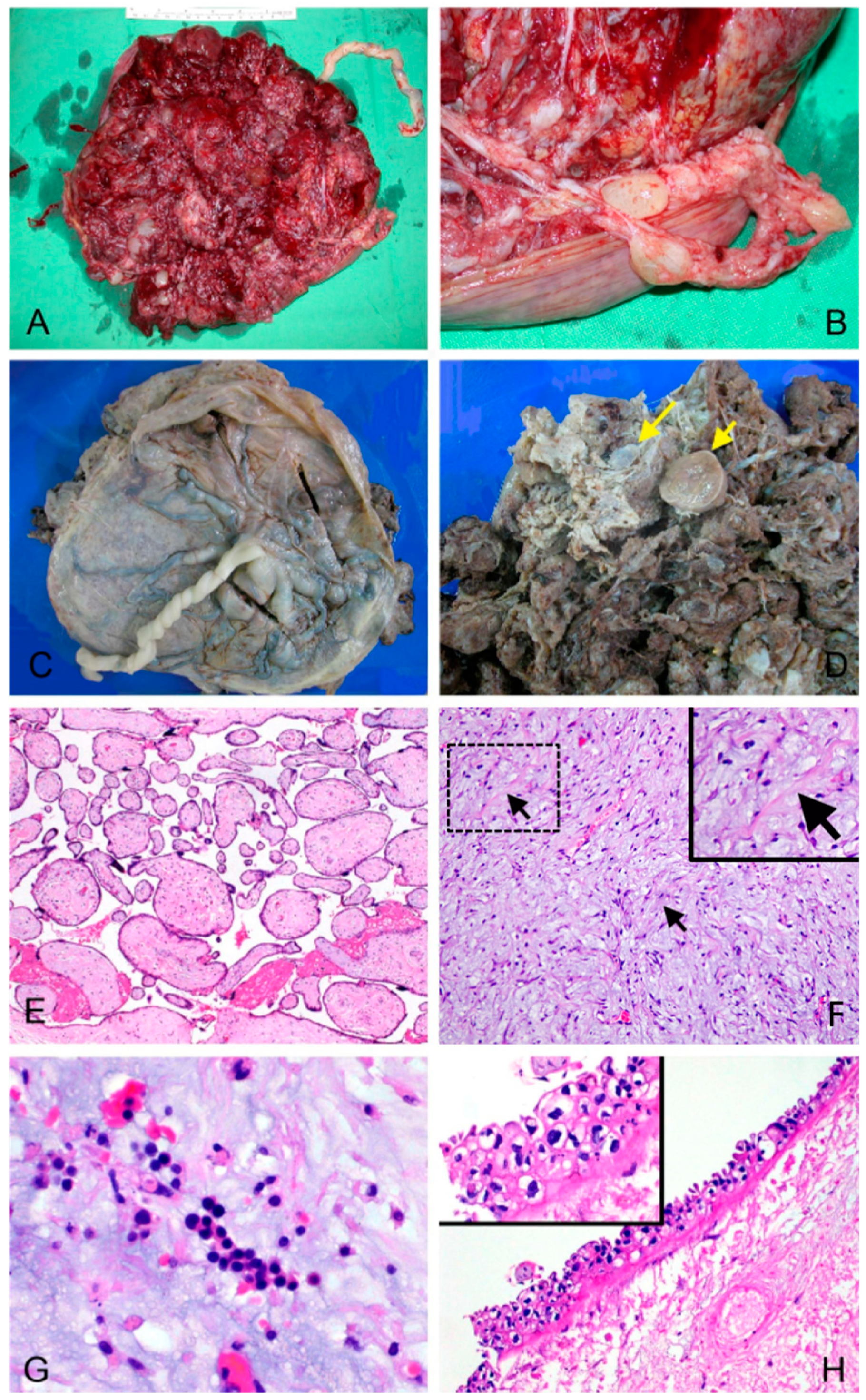 Biomedicines 09 00544 g001