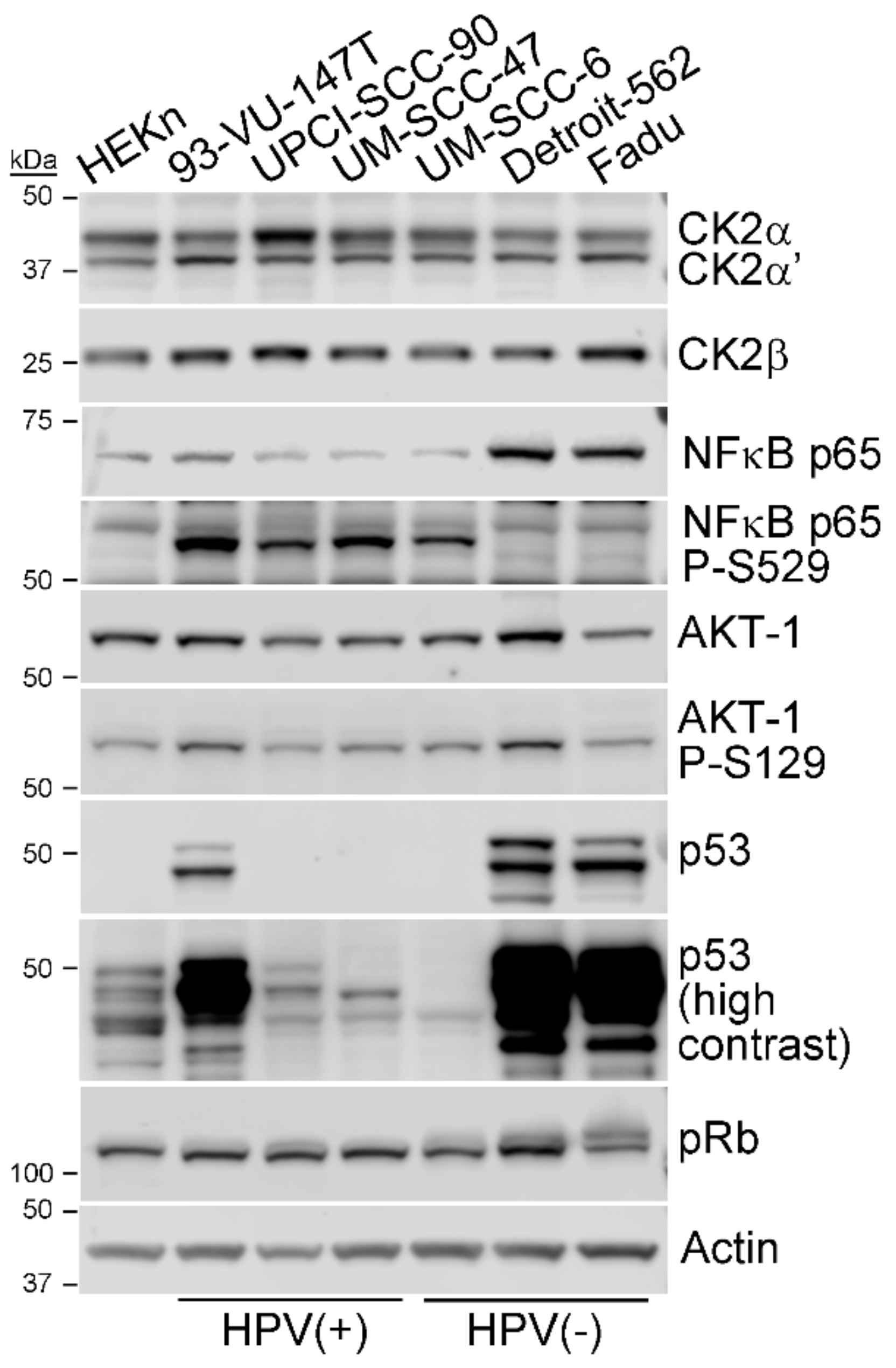 CX-4945 and siRNA-Mediated Knockdown of CK2 Improves Cisplatin