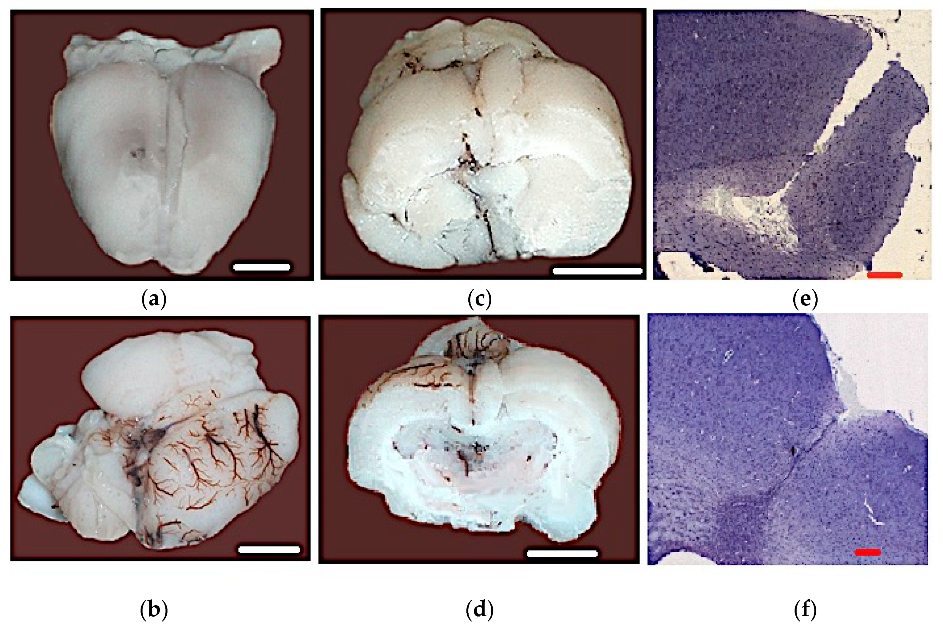 Biomedicines 09 00585 g002 Biomedicines 09 00585 g002