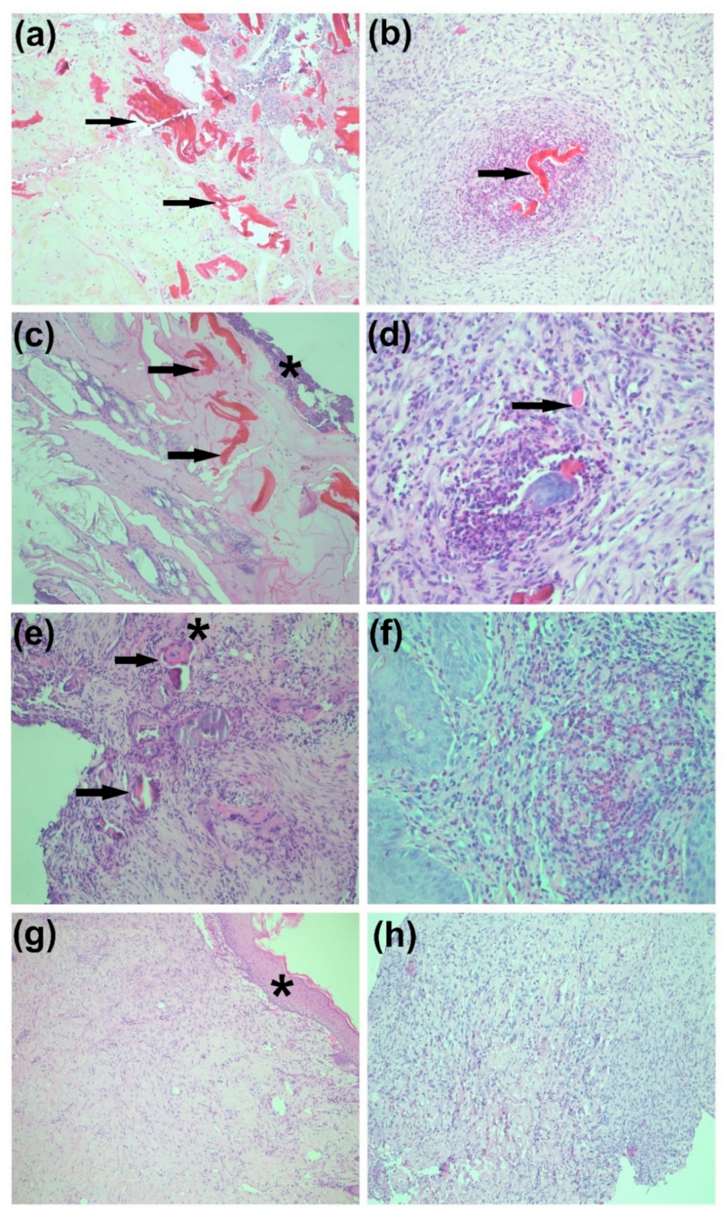 Biomedicines 09 00590 g015