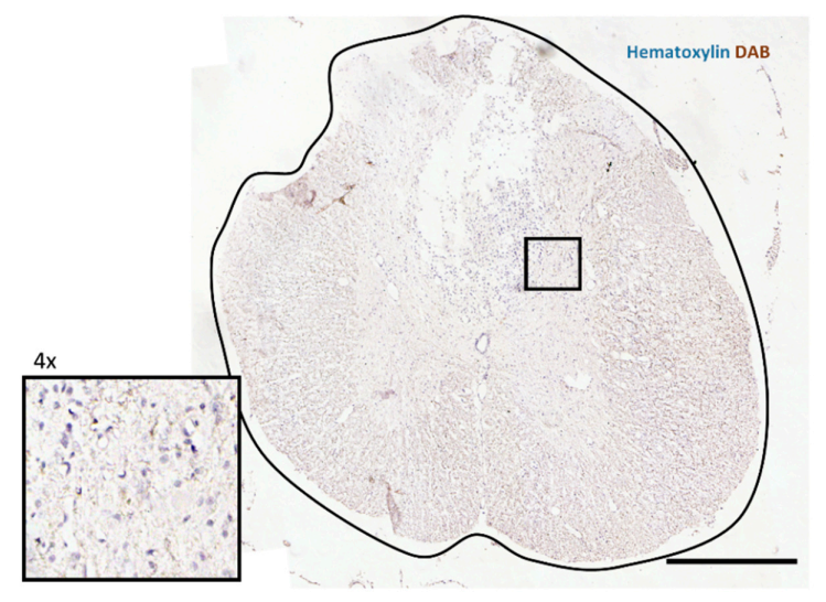 Biomedicines 09 00593 g0a1 Biomedicines 09 00593 g0a1