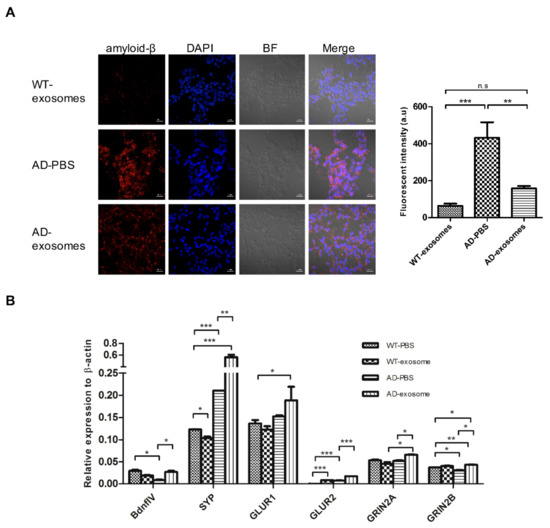 Mesenchymal Stem Cell-Derived Exosomes Ameliorate