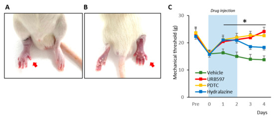 Possible Therapeutic Options for Complex Regional Pain Syndrome
