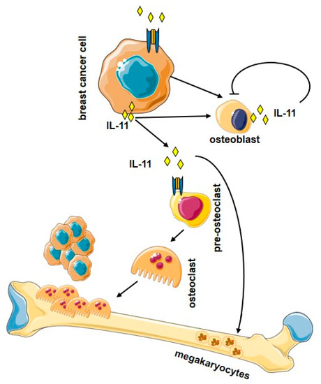 Interleukin 11 (IL-11): Role(s) in Breast Cancer Bone Metastases