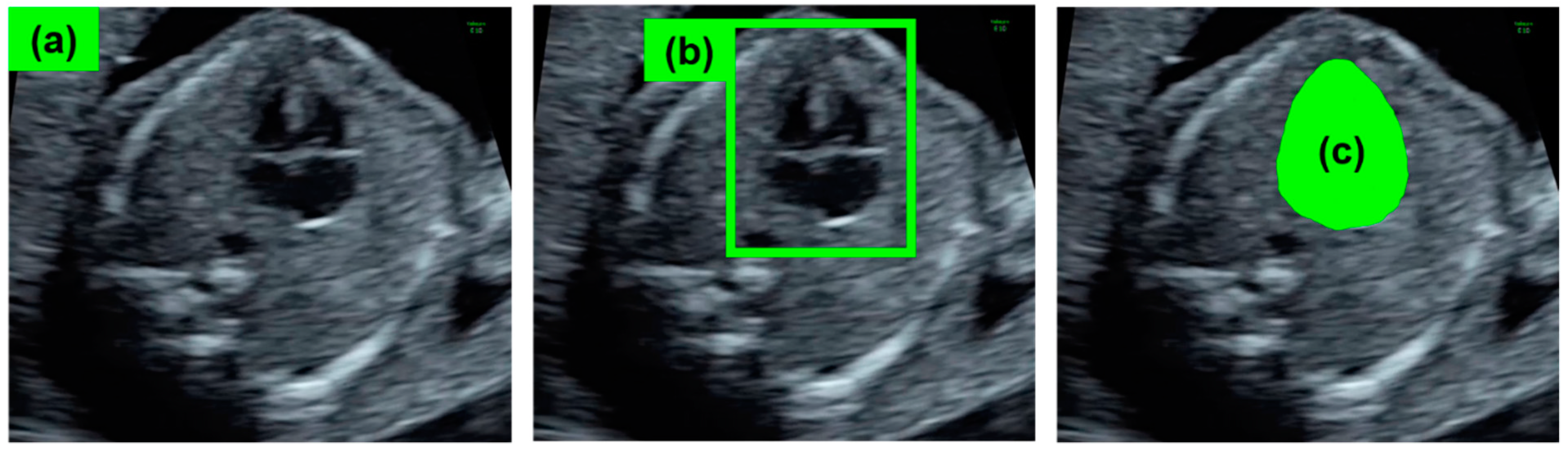 Biomedicines 09 00720 g002