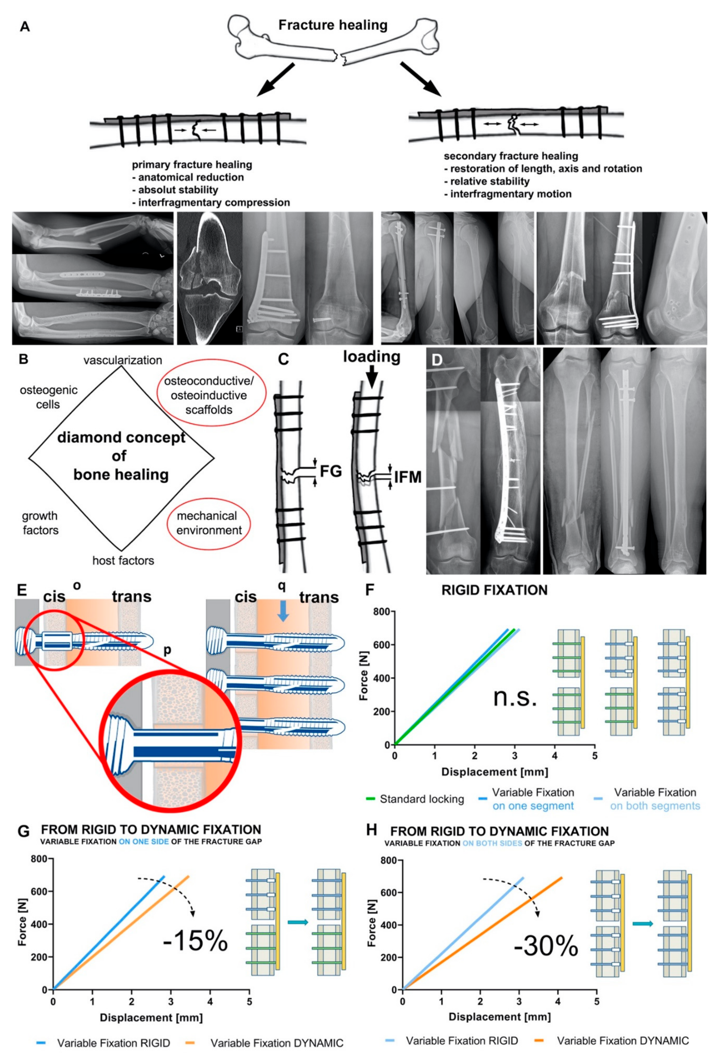 The role of mechanical stimulation in the enhancement of bone
