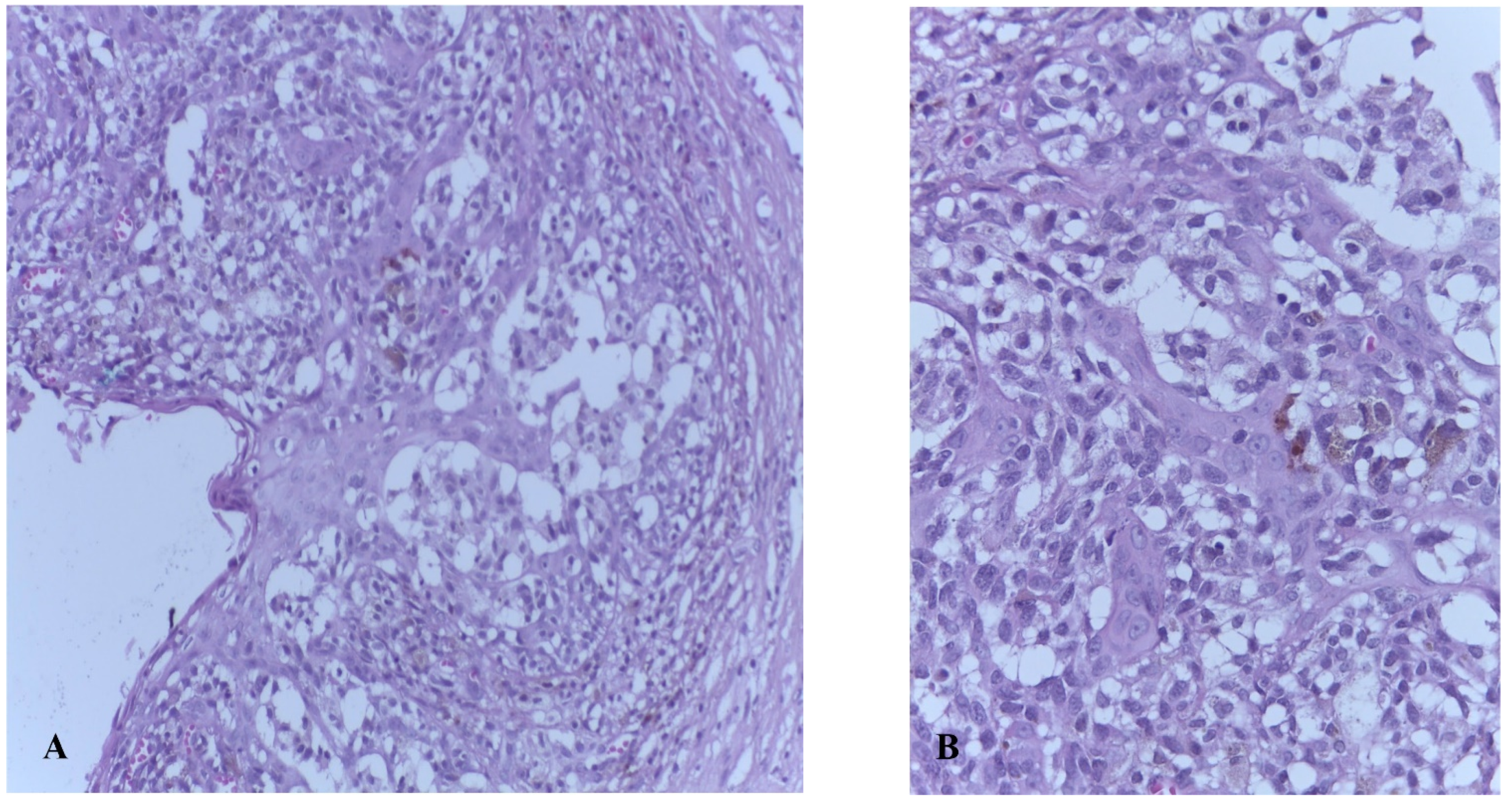 Biomedicines 09 00758 g005