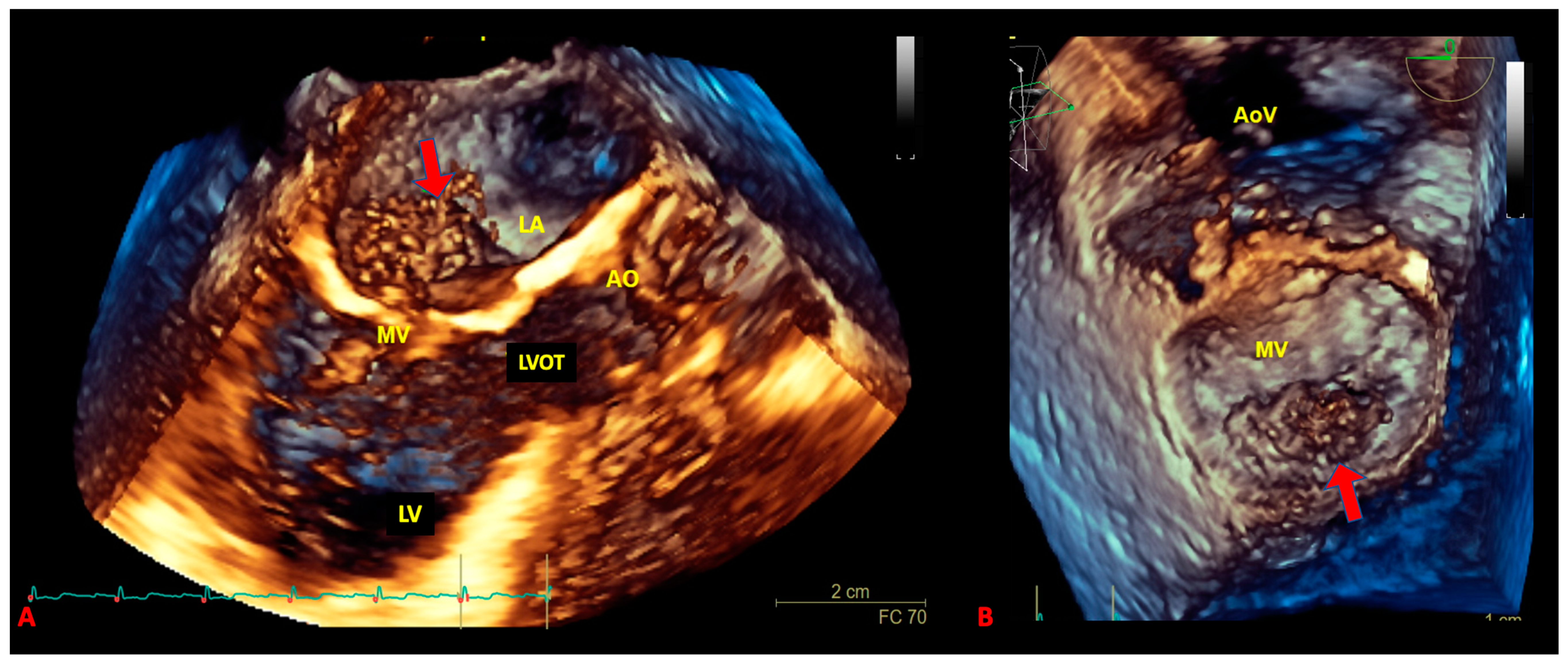 Biomedicines 09 00774 g004 Biomedicines 09 00774 g004