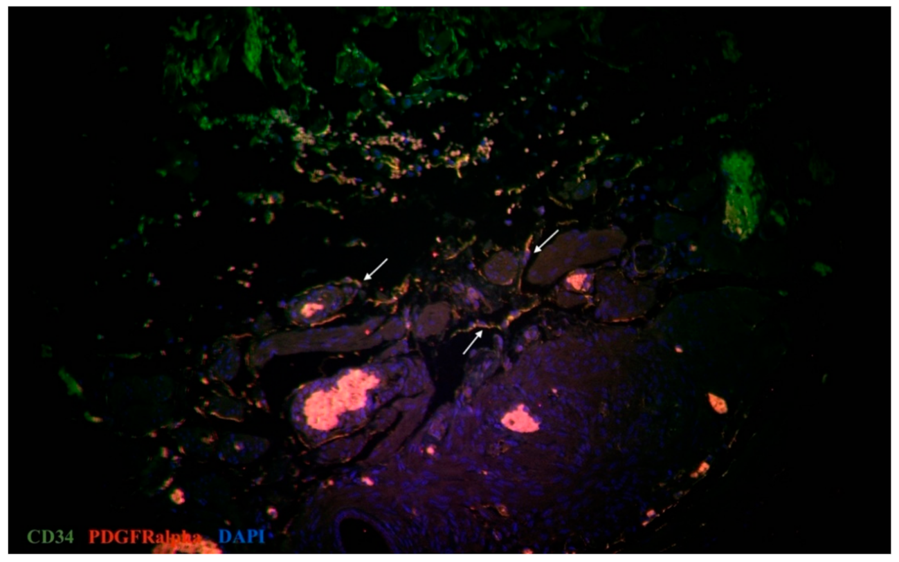 Biomedicines 09 01060 g003 550