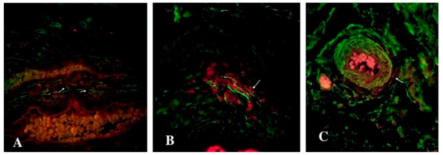 Biomedicines 09 01060 g006 550