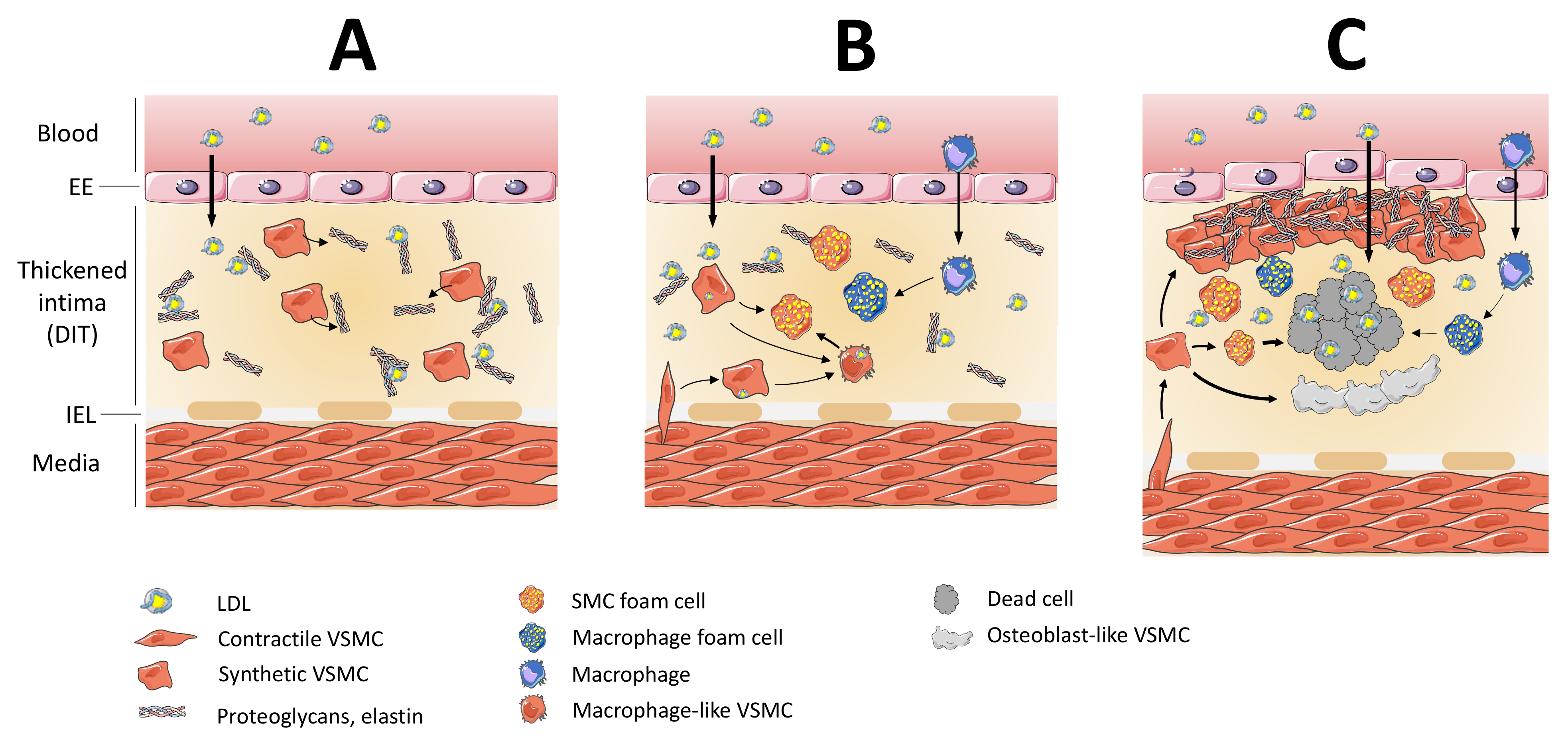 Biomedicines Free Full Text Macrophages In Atherosclerosis First Or Second Row Players Html Biomedicines Free Full Text Macrophages In Atherosclerosis First Or Second Row Players Html