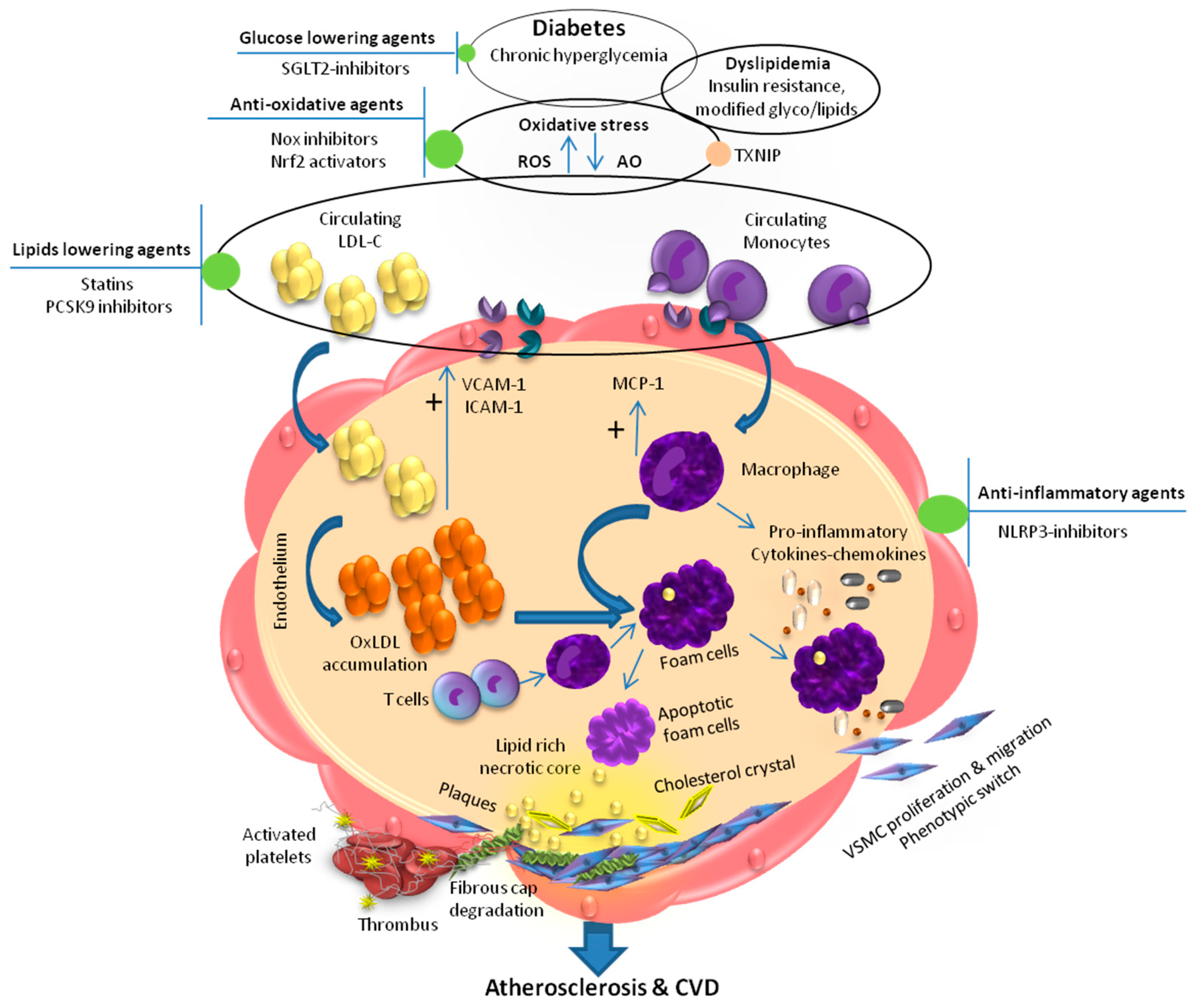 angina során diabetes mellitus