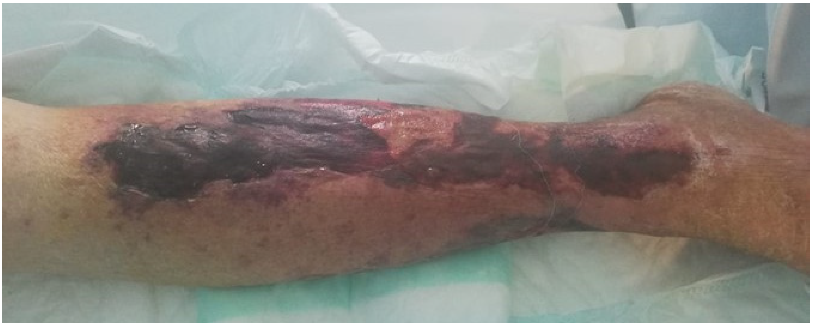 Biomedicines 09 01626 g002