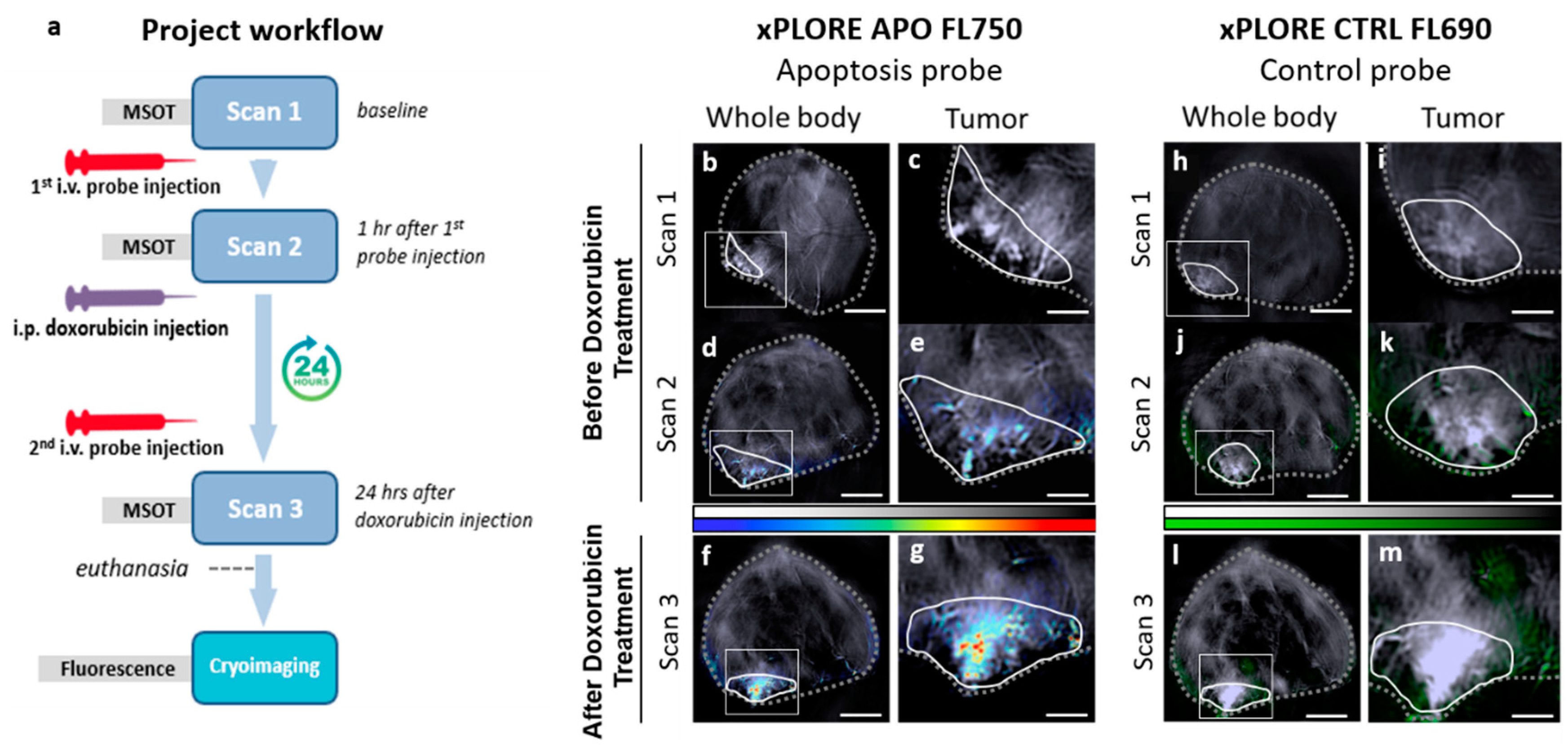 Diagnostic Breast Imaging 第2版 Diagnostic Breast Imaging: Mammography, Sonography, Magnetic