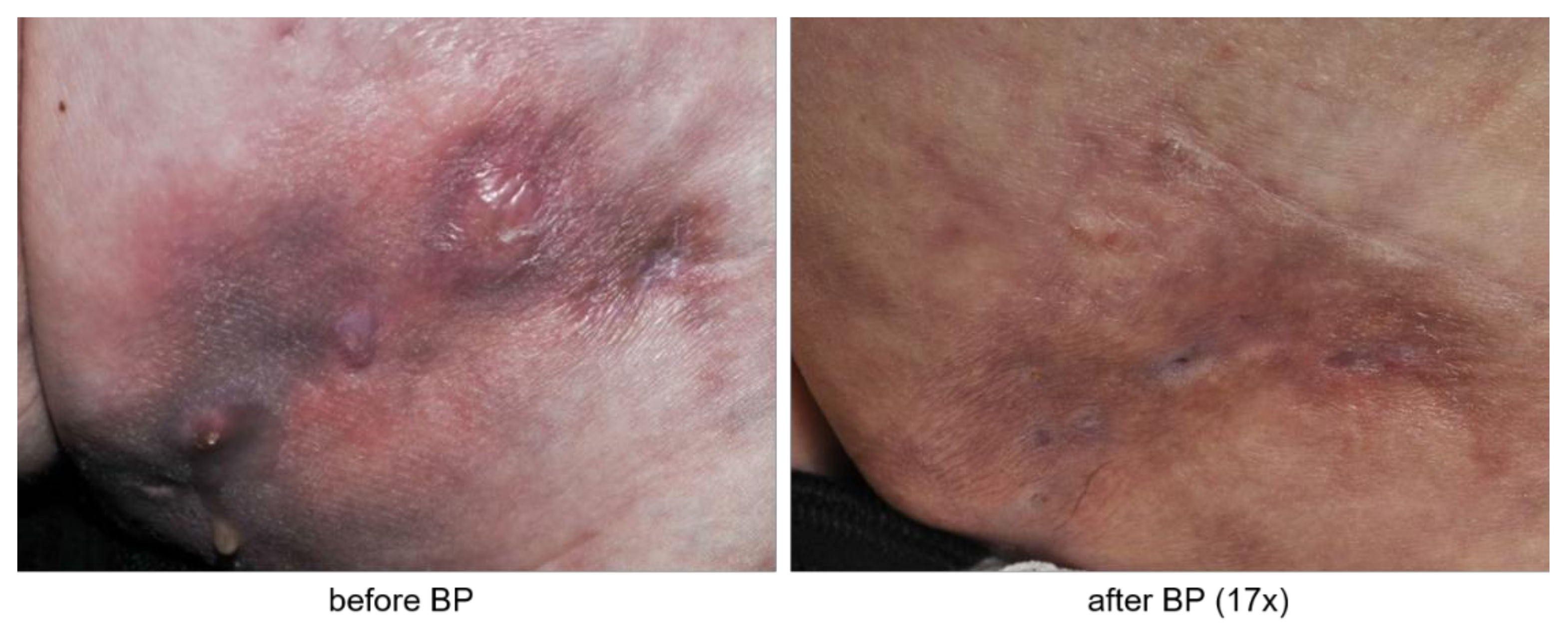 Biomedicines 09 01698 g002 550