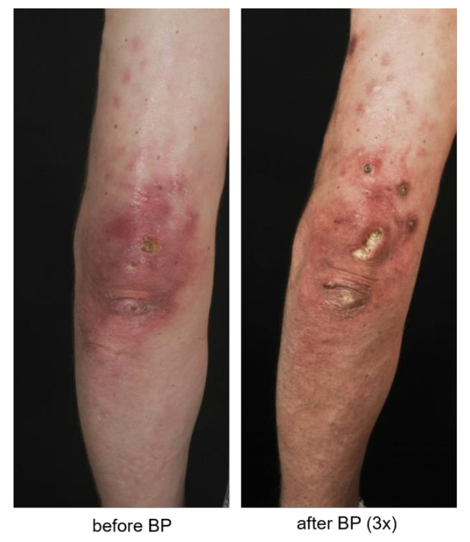 Biomedicines 09 01698 g003 550