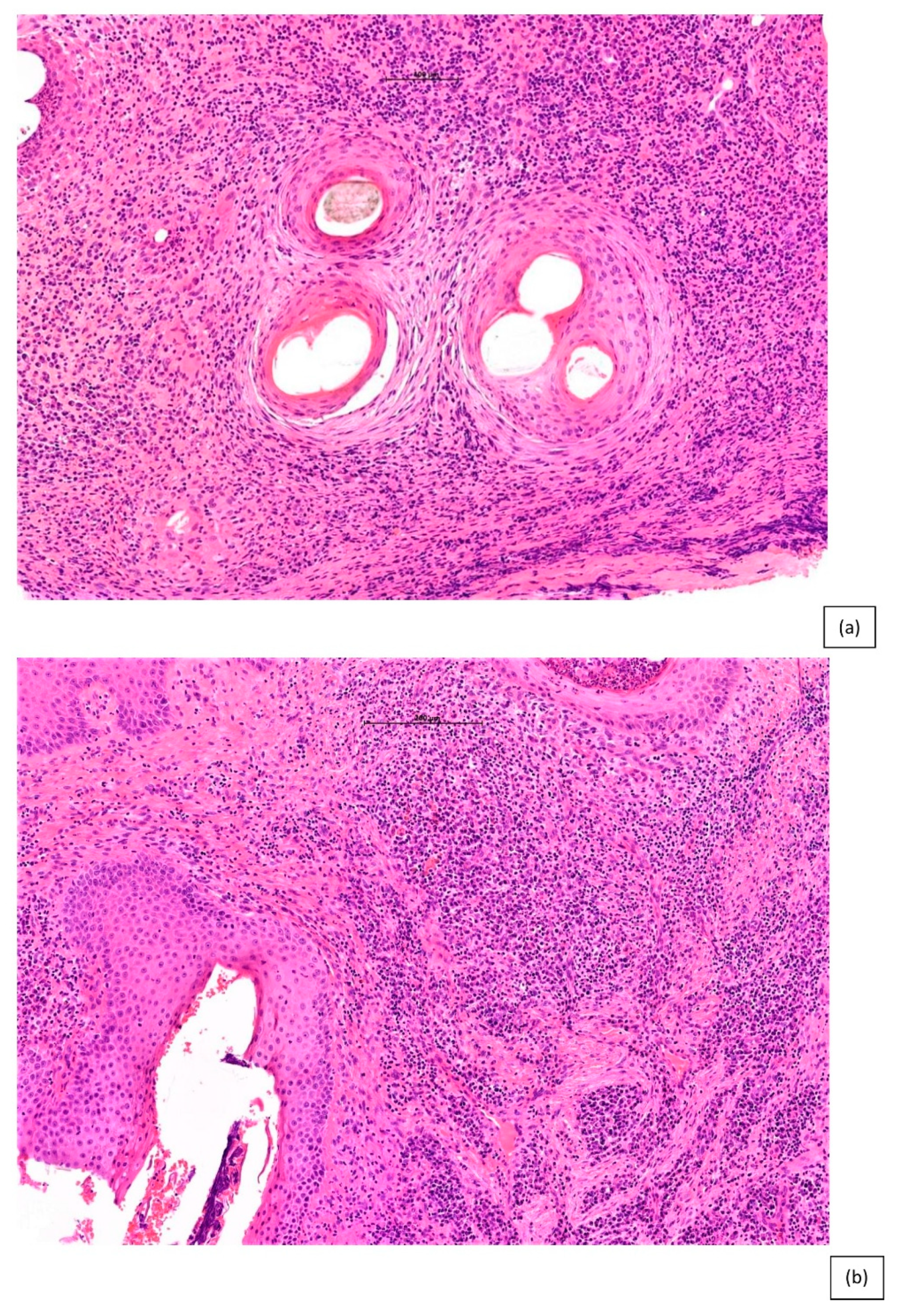 Biomedicines 09 01755 g006