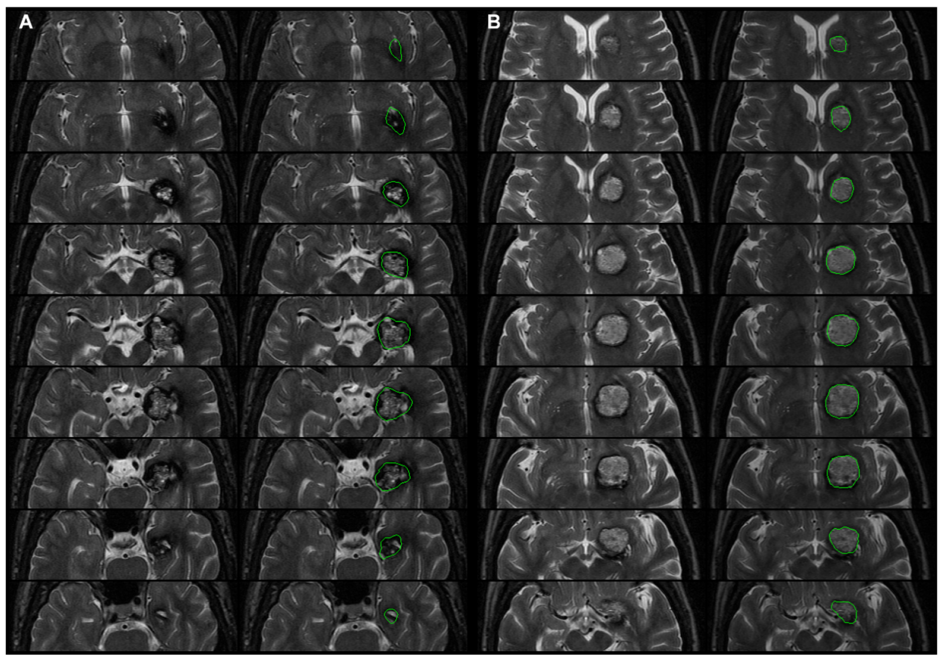 Biomedicines 09 01872 g002 550