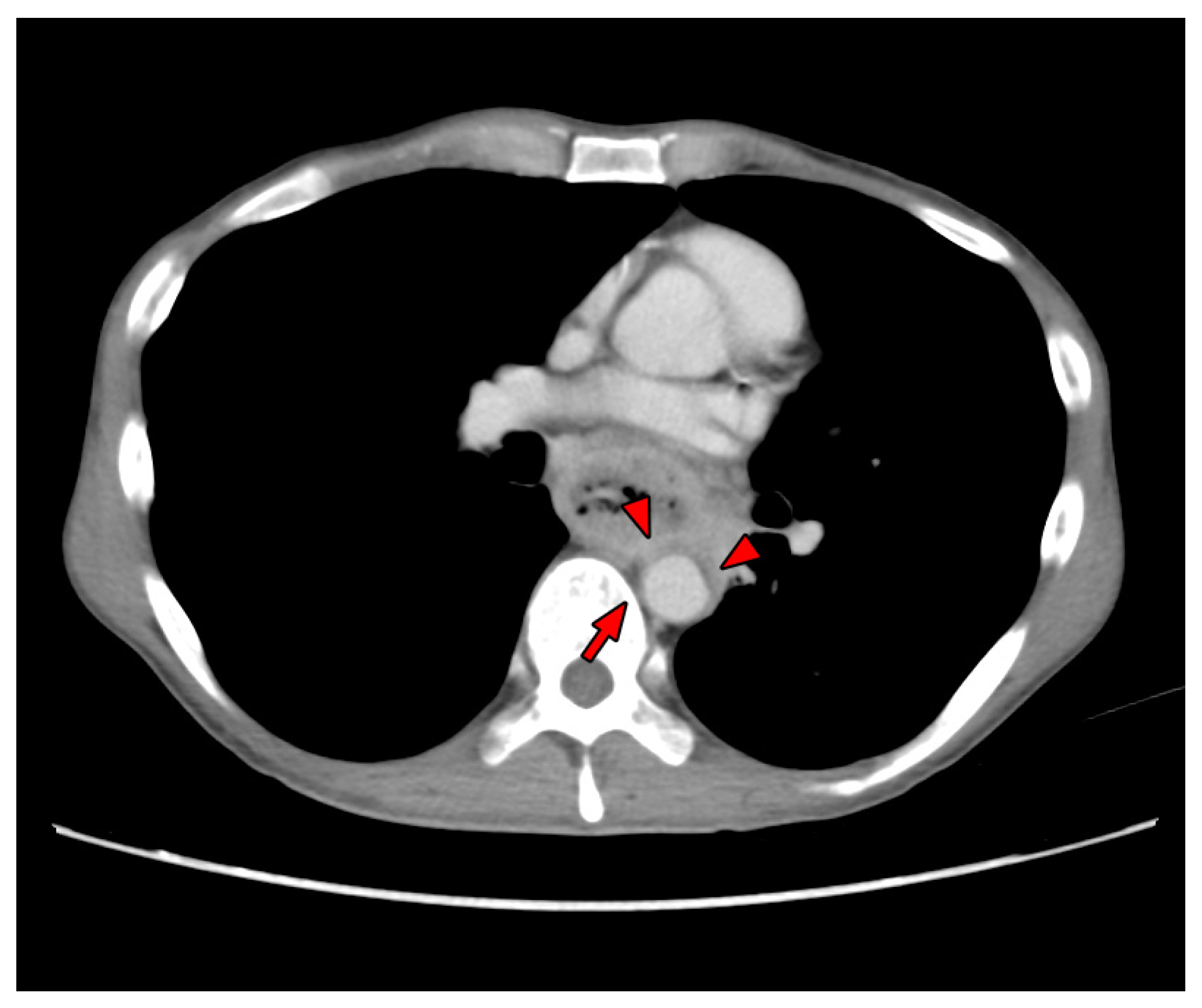 Biomedicines 09 01889 g001 550