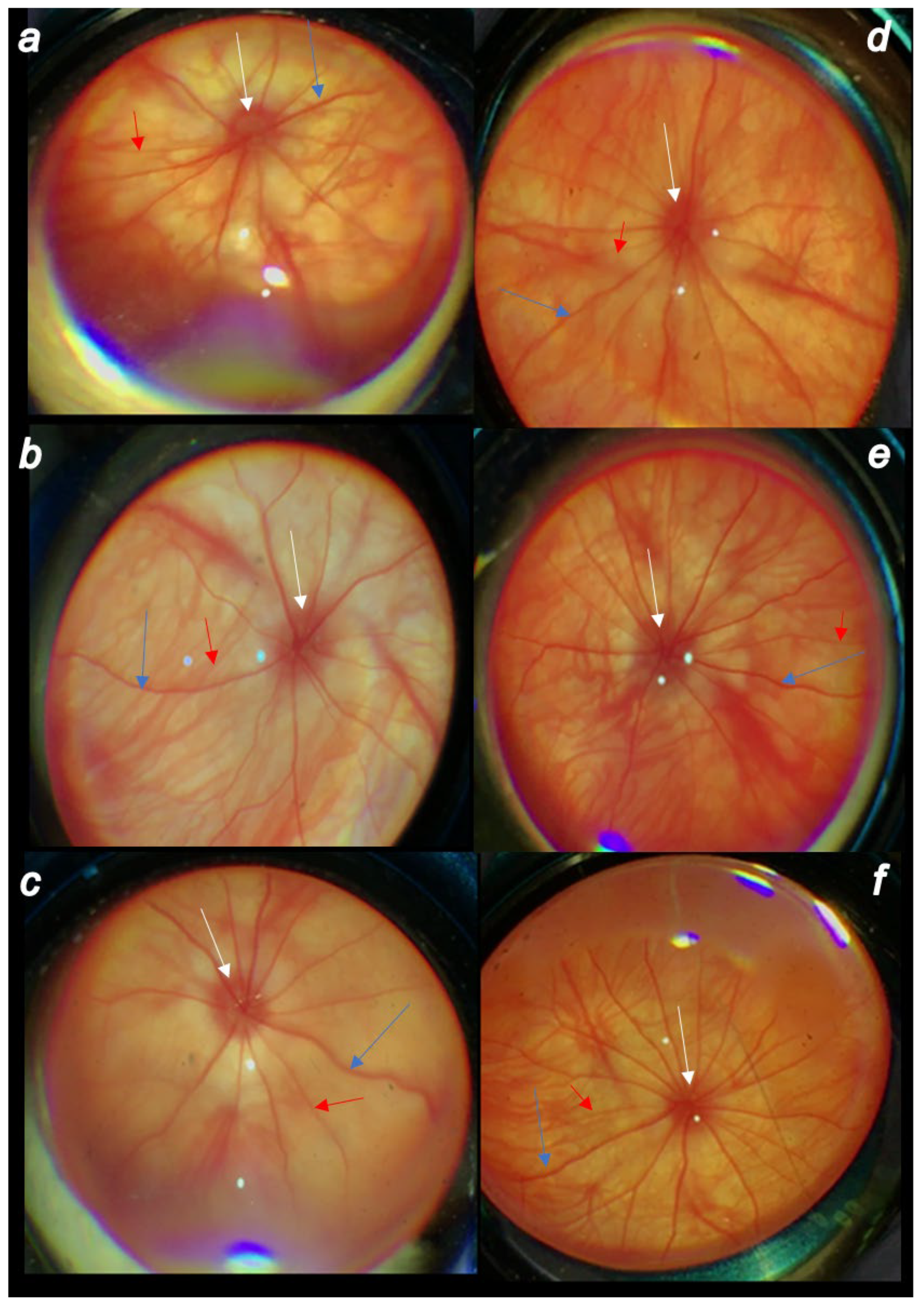Biomedicines 10 00089 g006