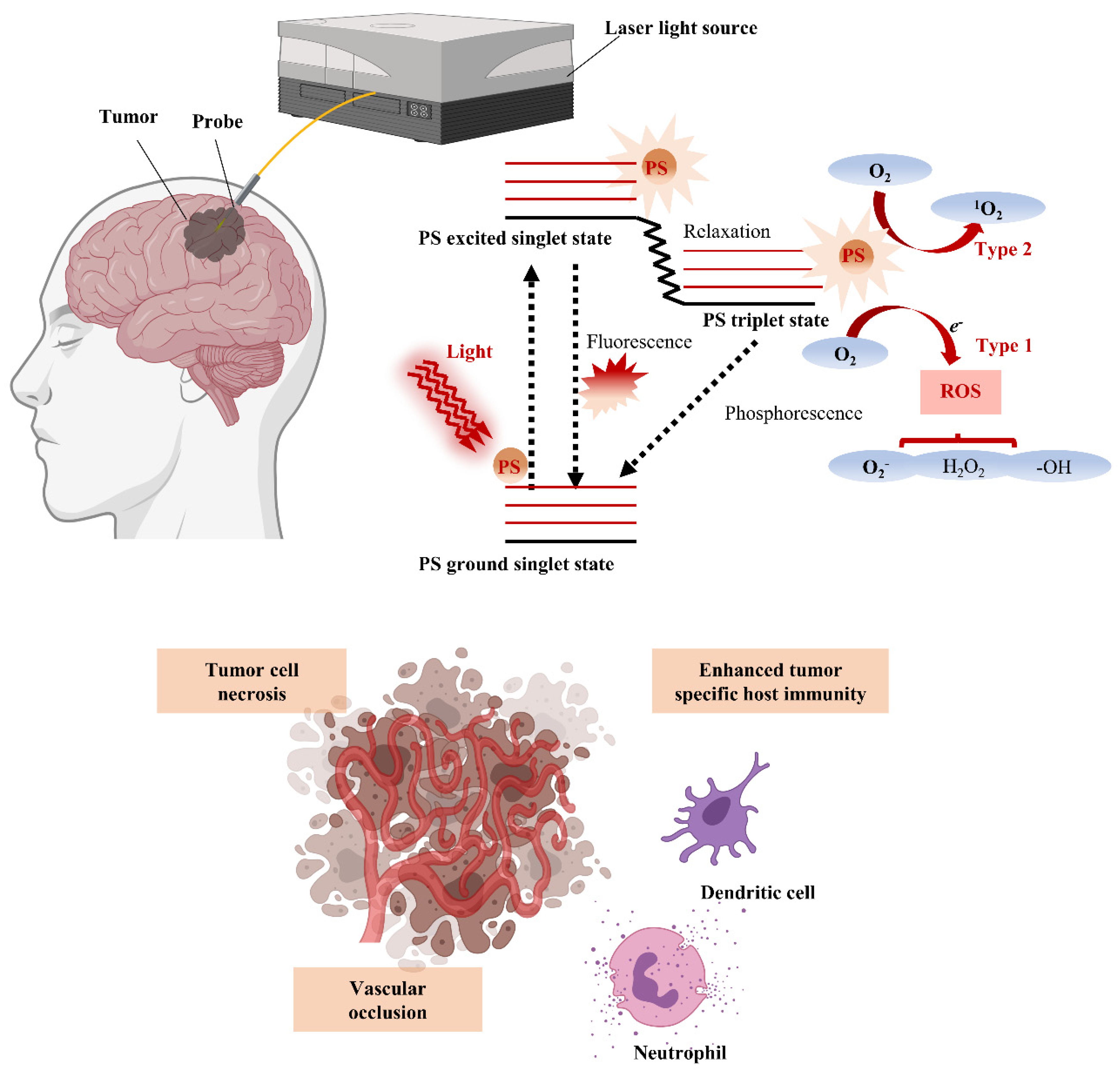 Revolutionizing the Treatment of Brain Disorders - SBU News