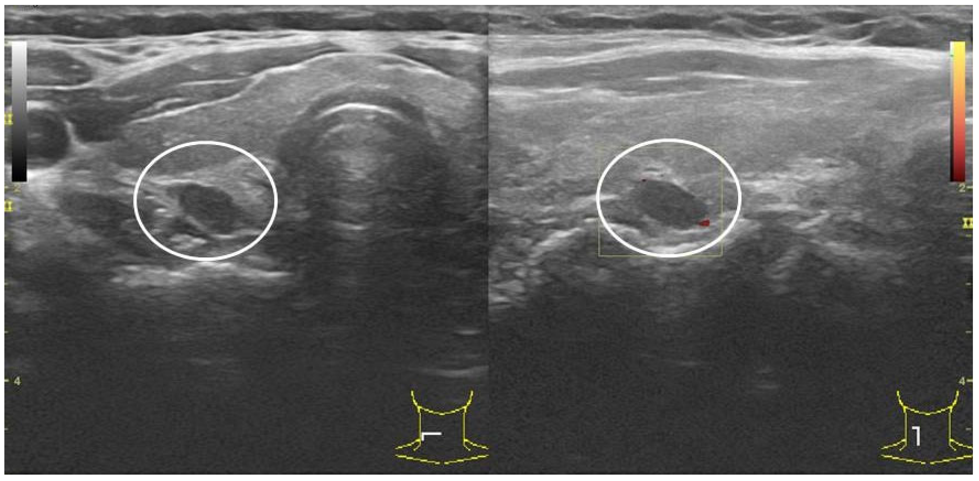 Biomedicines 10 00123 g003 550