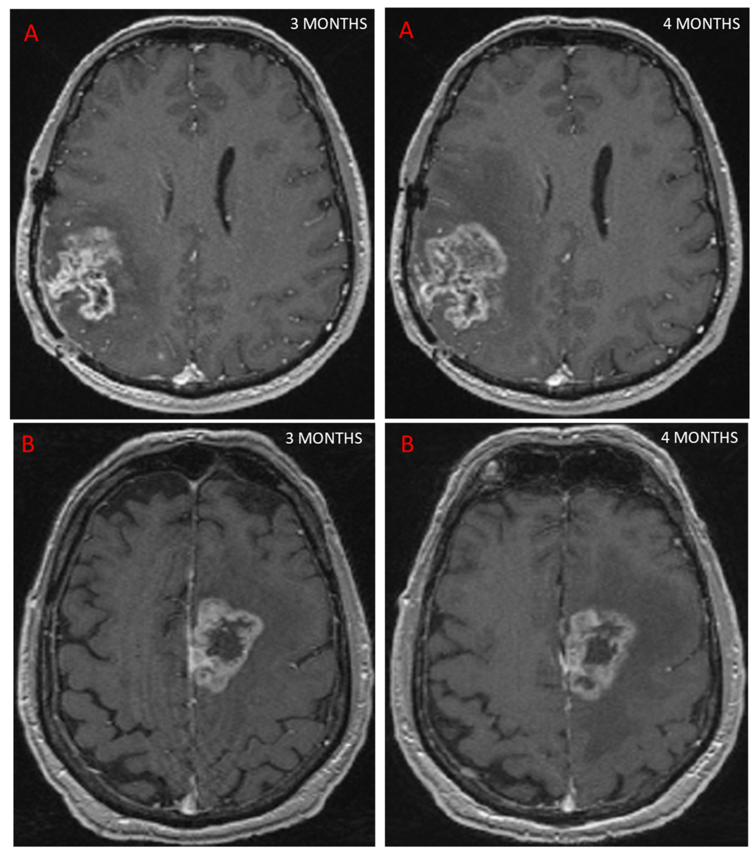 Biomedicines 10 00285 g002 550