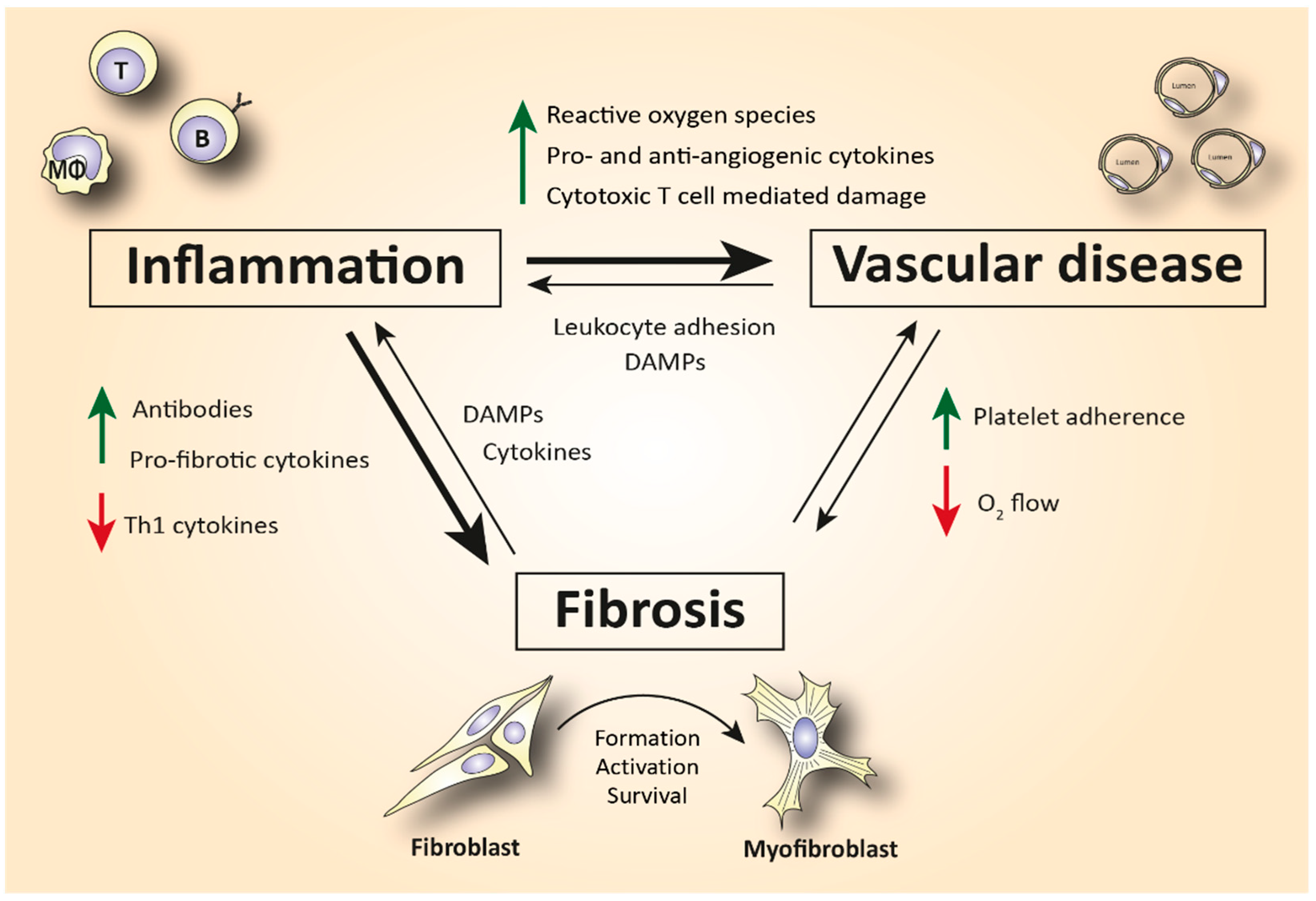 Gyre Therapeutics – Focused on organ fibrosis and inflammatory disease