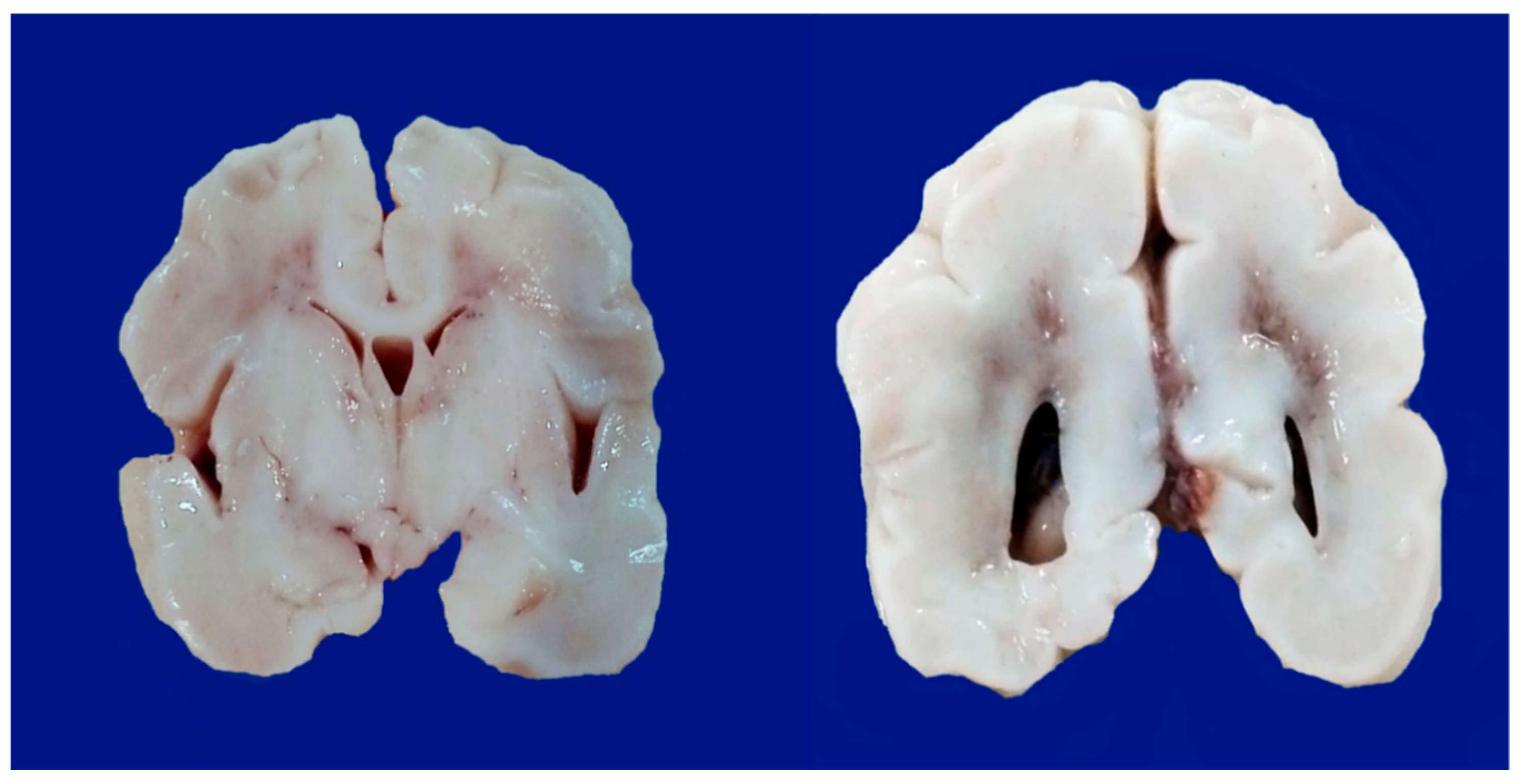 Biomedicines 10 00347 g004