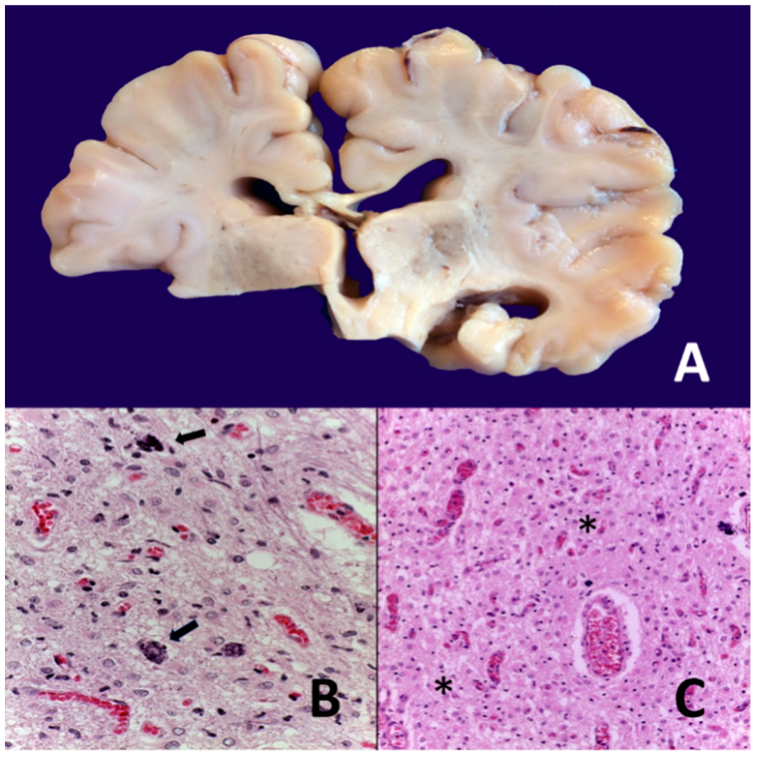 Biomedicines 10 00347 g005