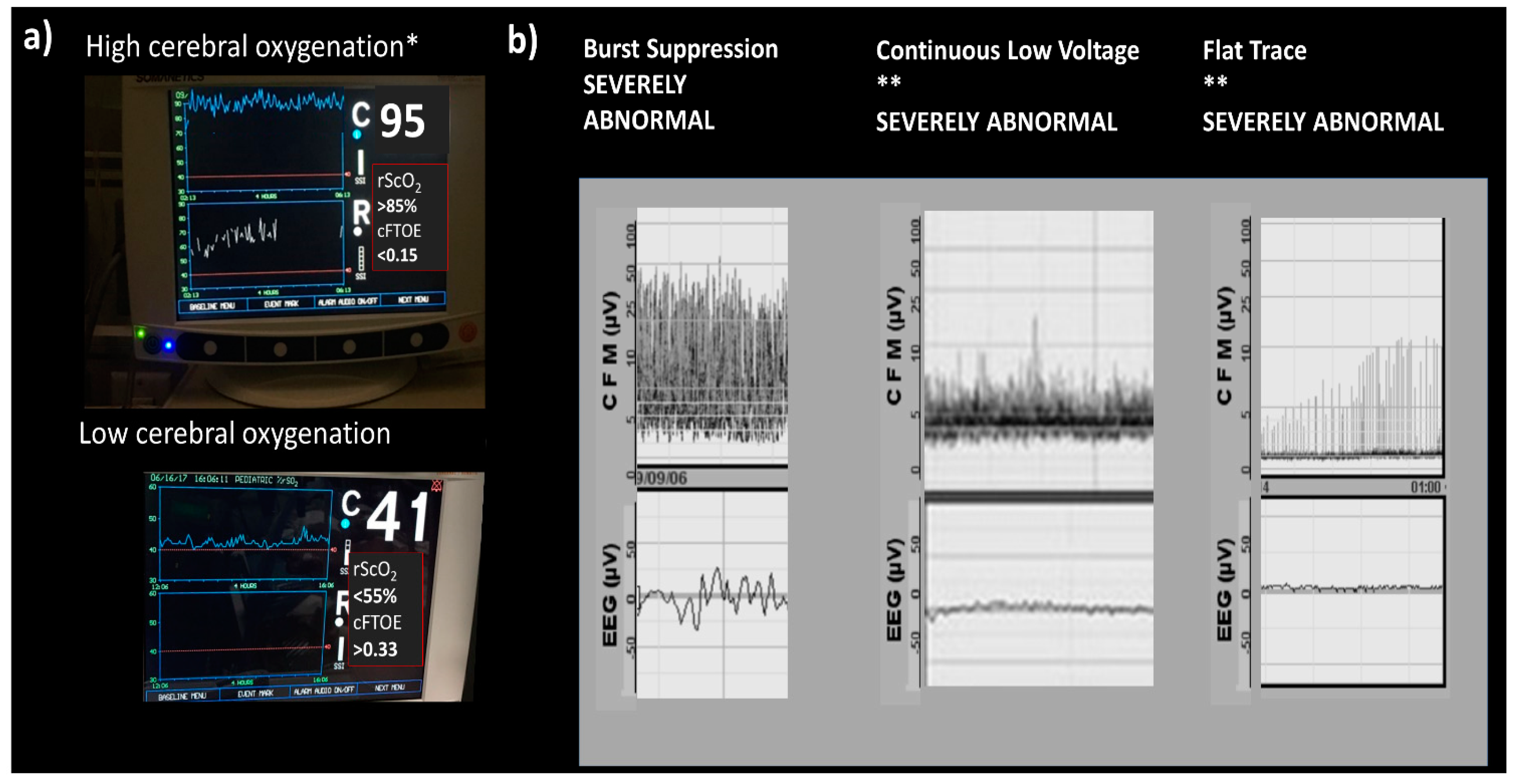 Biomedicines 10 00347 g006