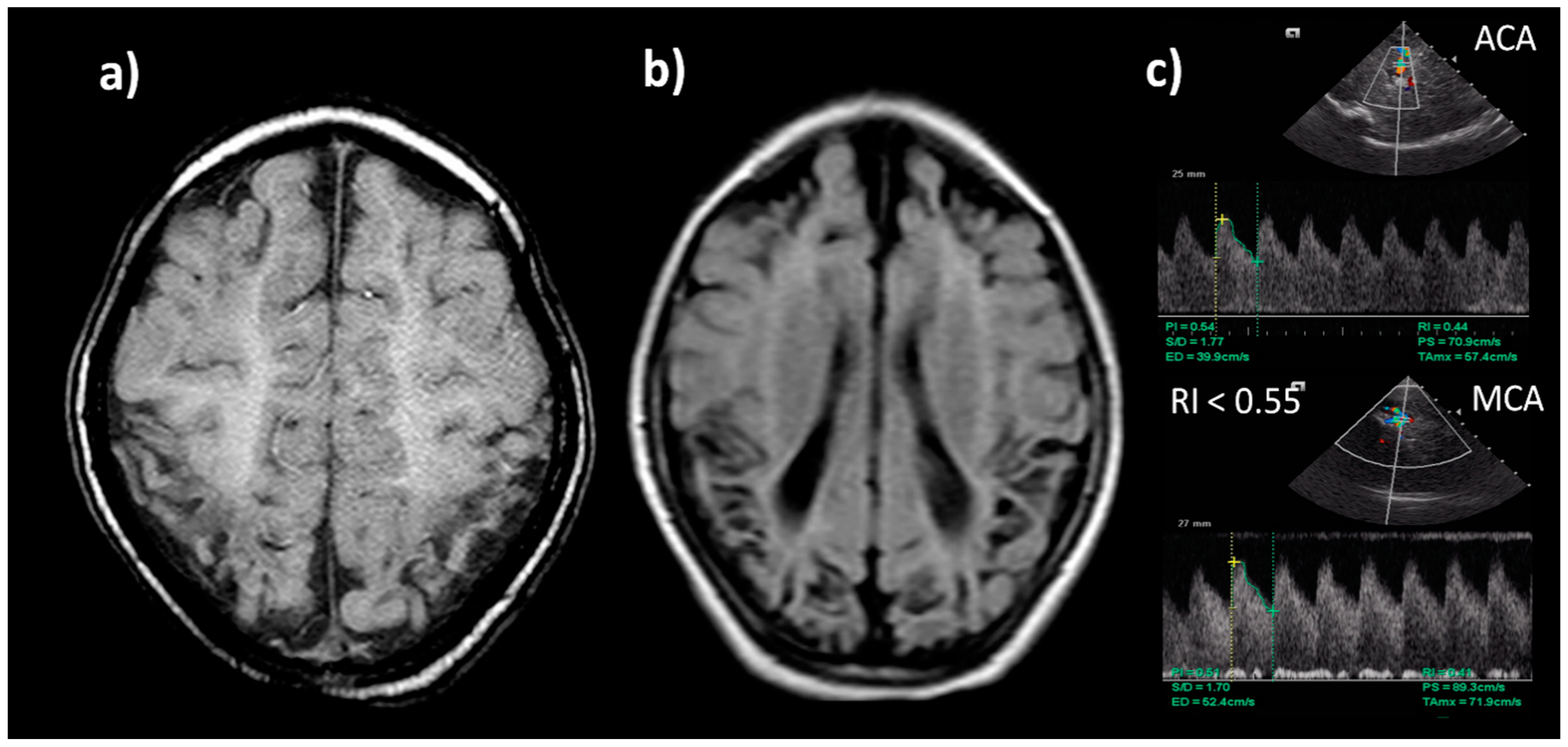 Biomedicines 10 00347 g007