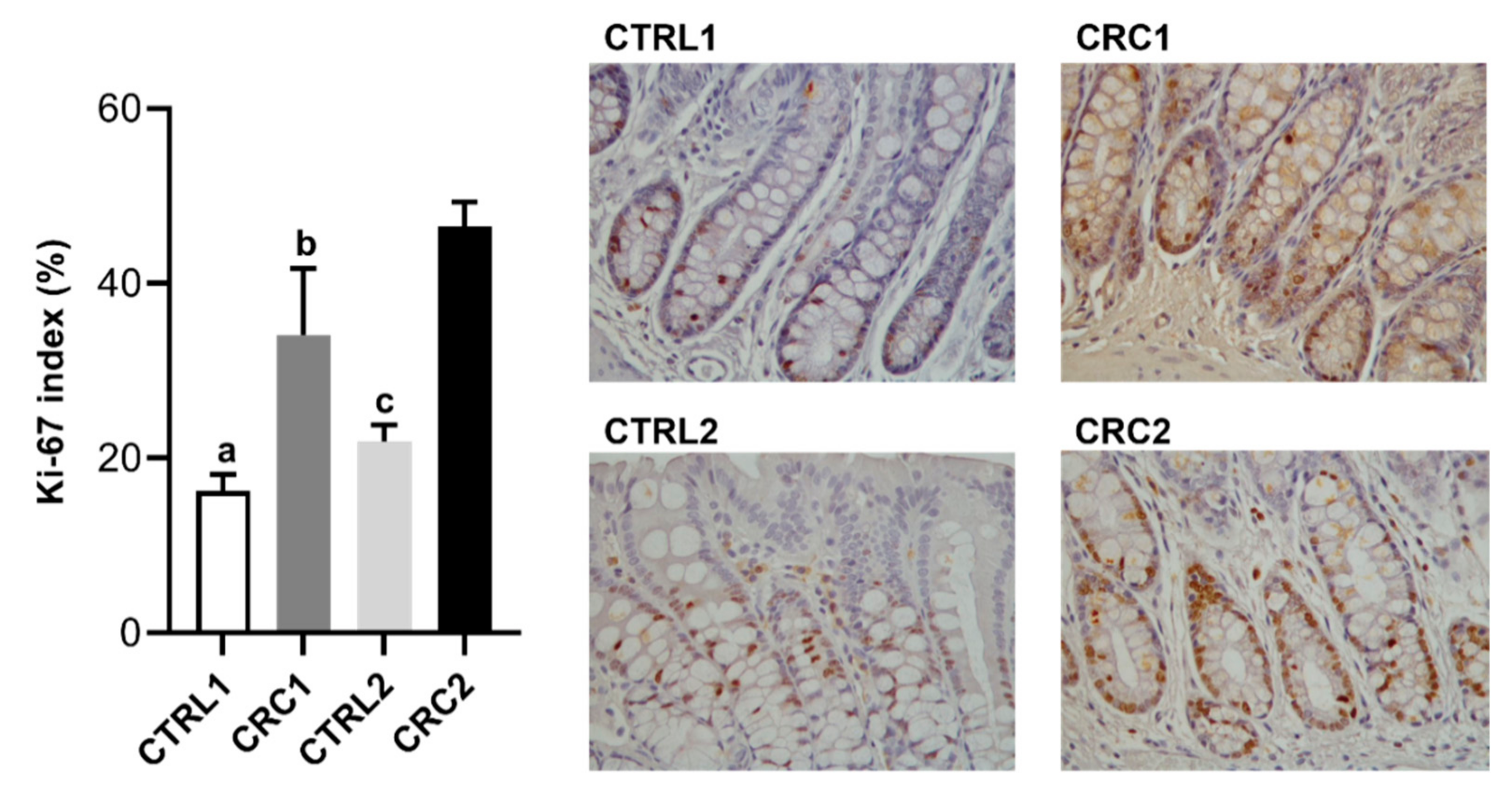 Biomedicines 10 00409 g005 Biomedicines 10 00409 g005