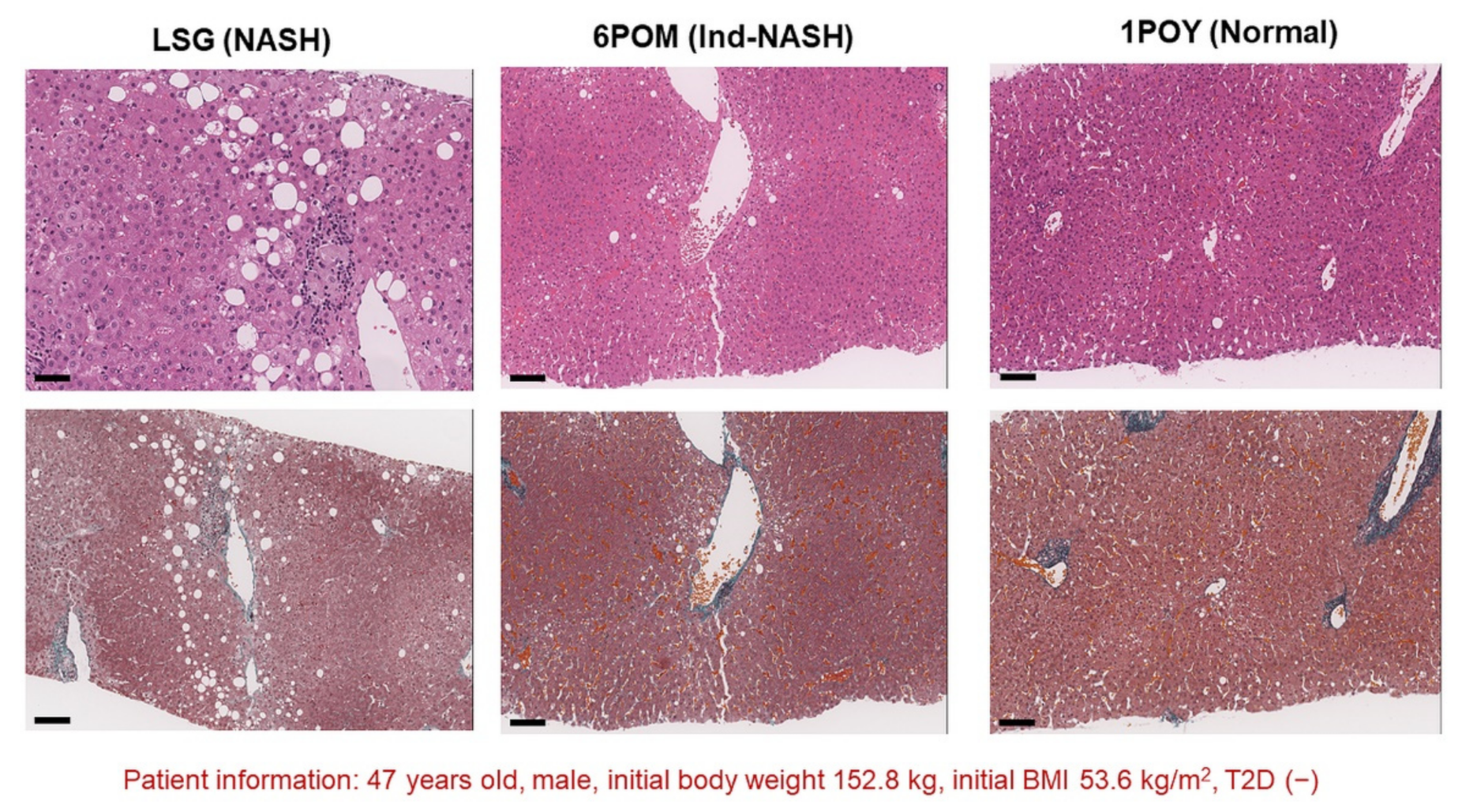 Biomedicines 10 00453 g006