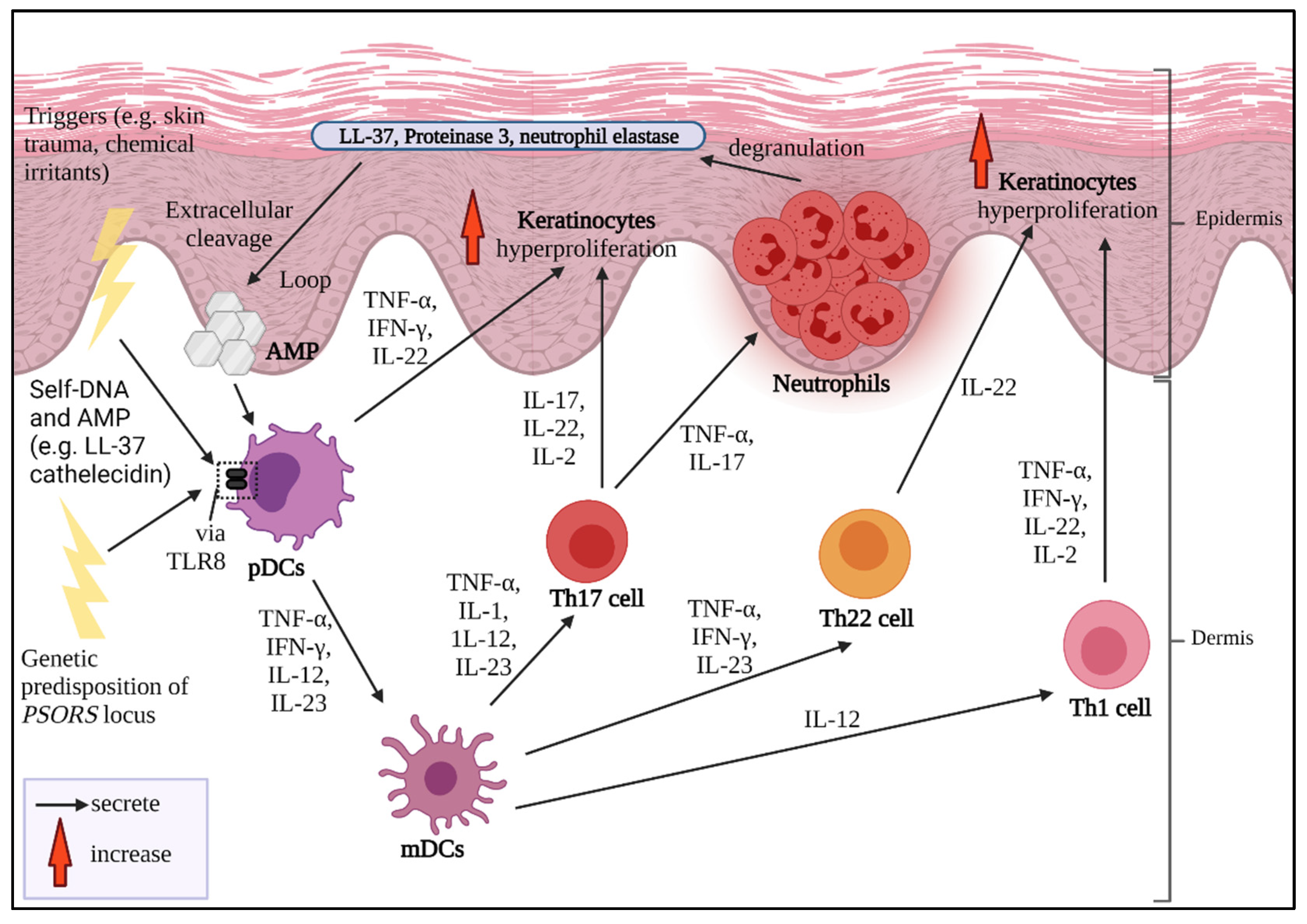 Plaque Psoriasis: Causes, Triggers, and Treatment: National Psoriasis  Foundation