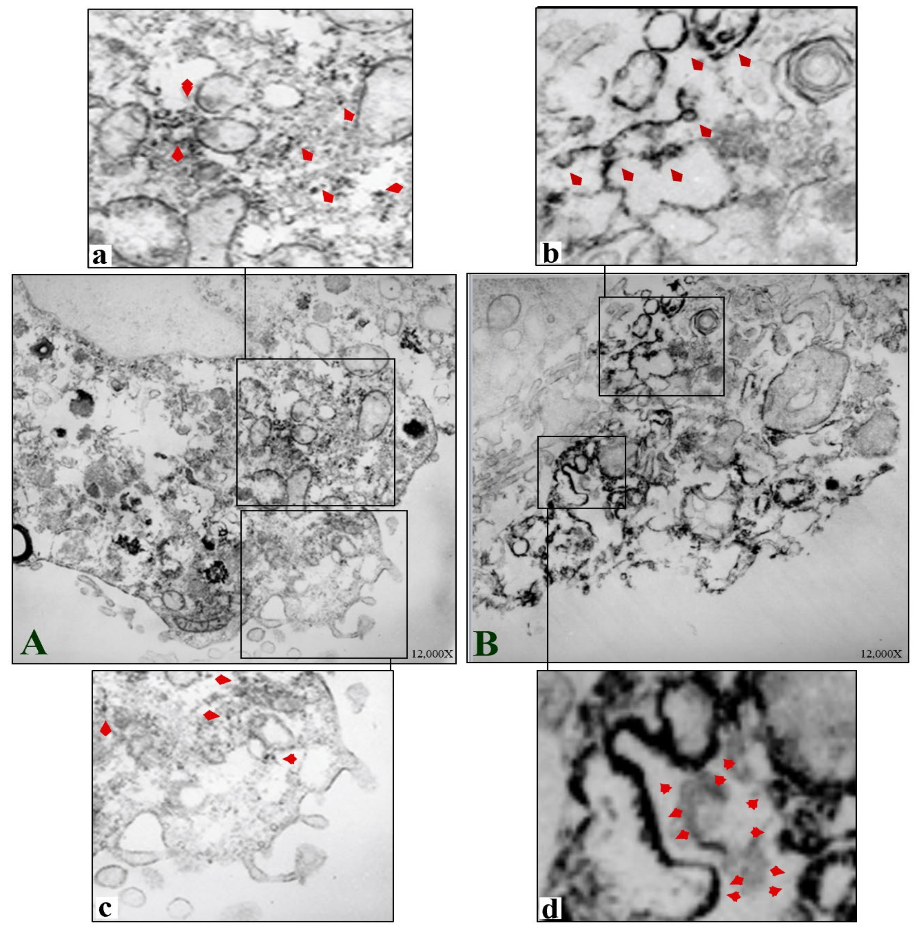 Biomedicines 10 00545 g006 Biomedicines 10 00545 g006