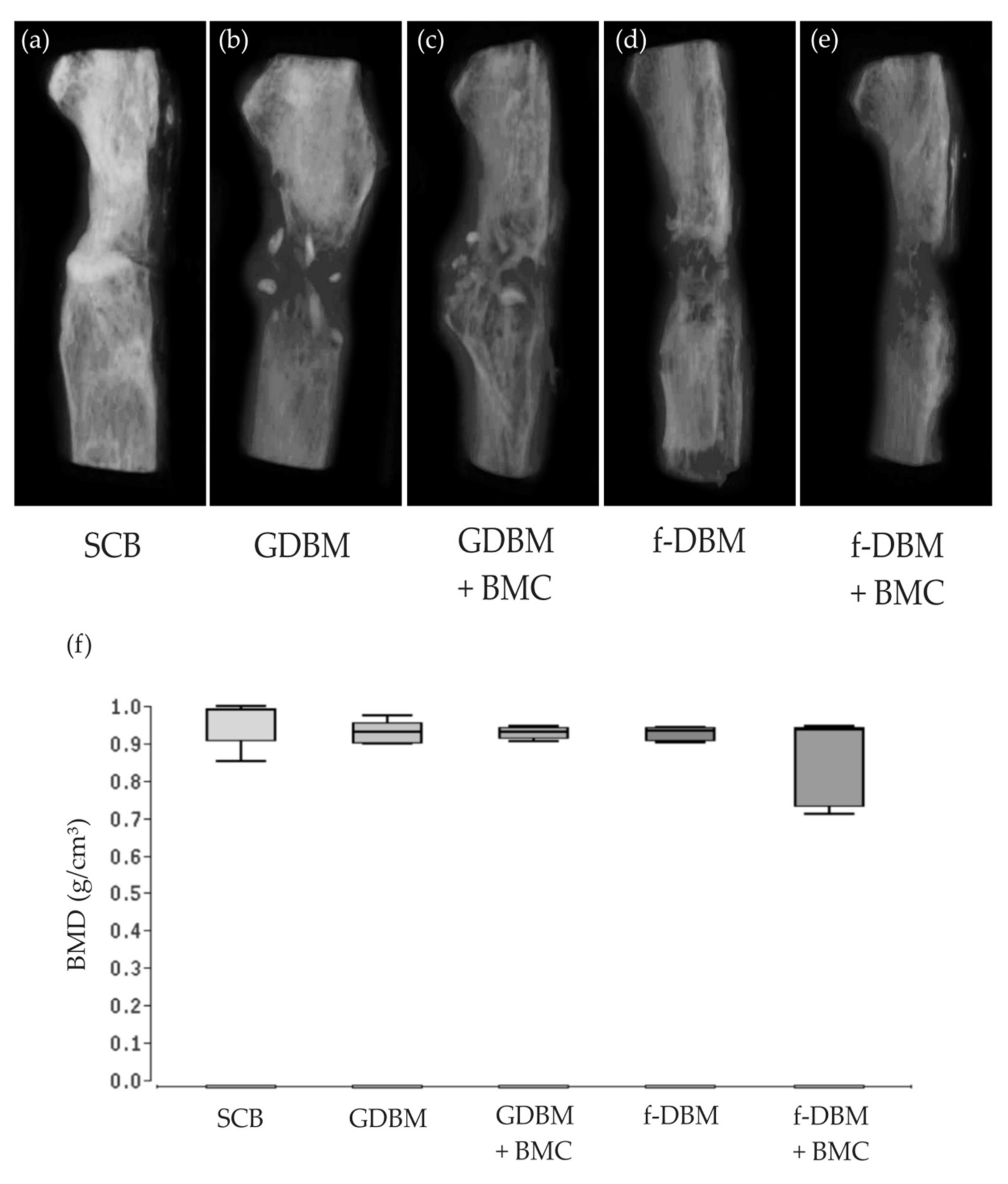 Biomedicines Free Full Text The Induced Membrane Technique Mdash The Filling Matters Evaluation Of Different Forms Of Membrane Filling With And Without Bone Marrow Mononuclear Cells Bmc In Large Femoral Bone Defects In